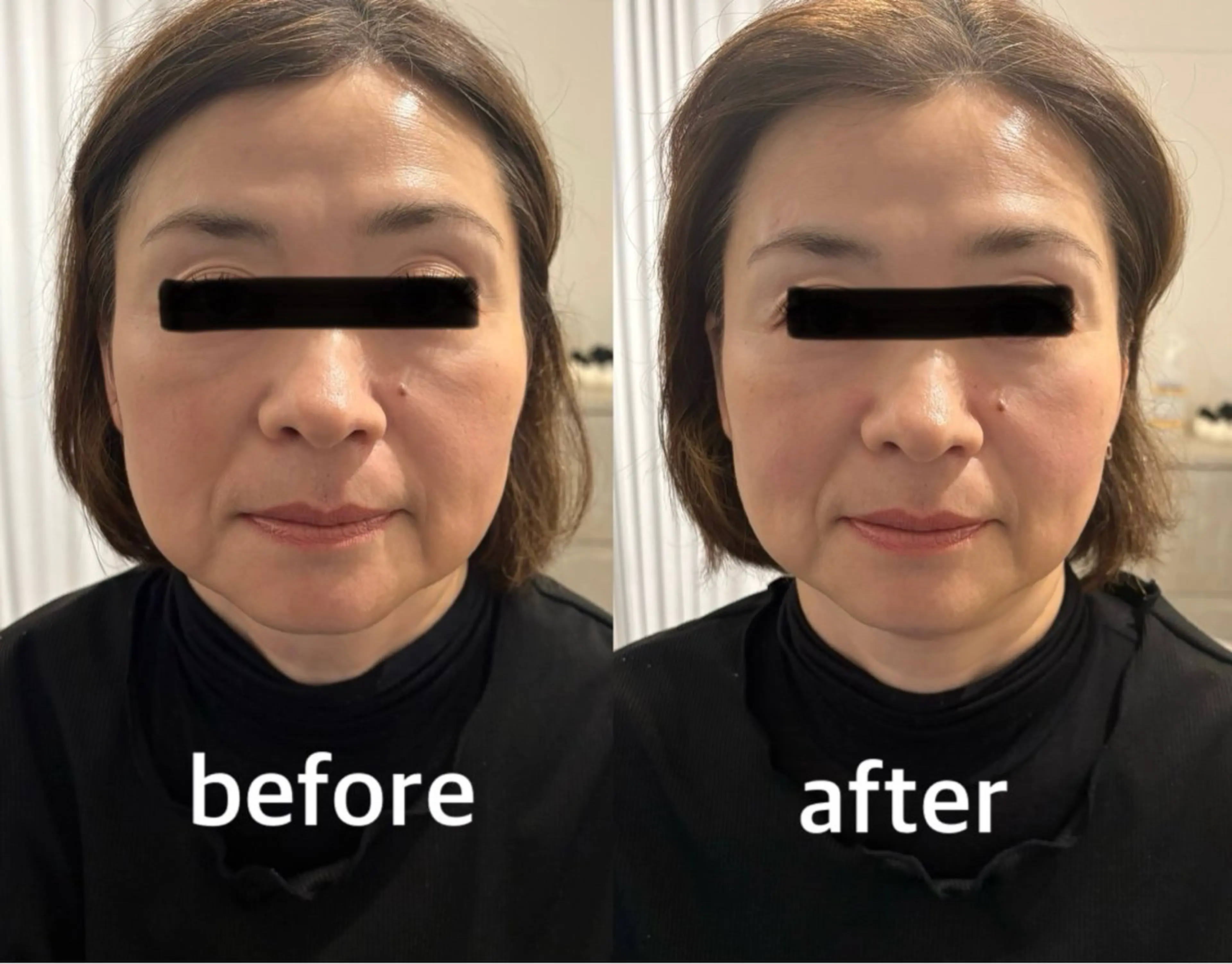 鍼灸サロン mahorobaトモのエステ・リラクイメージ