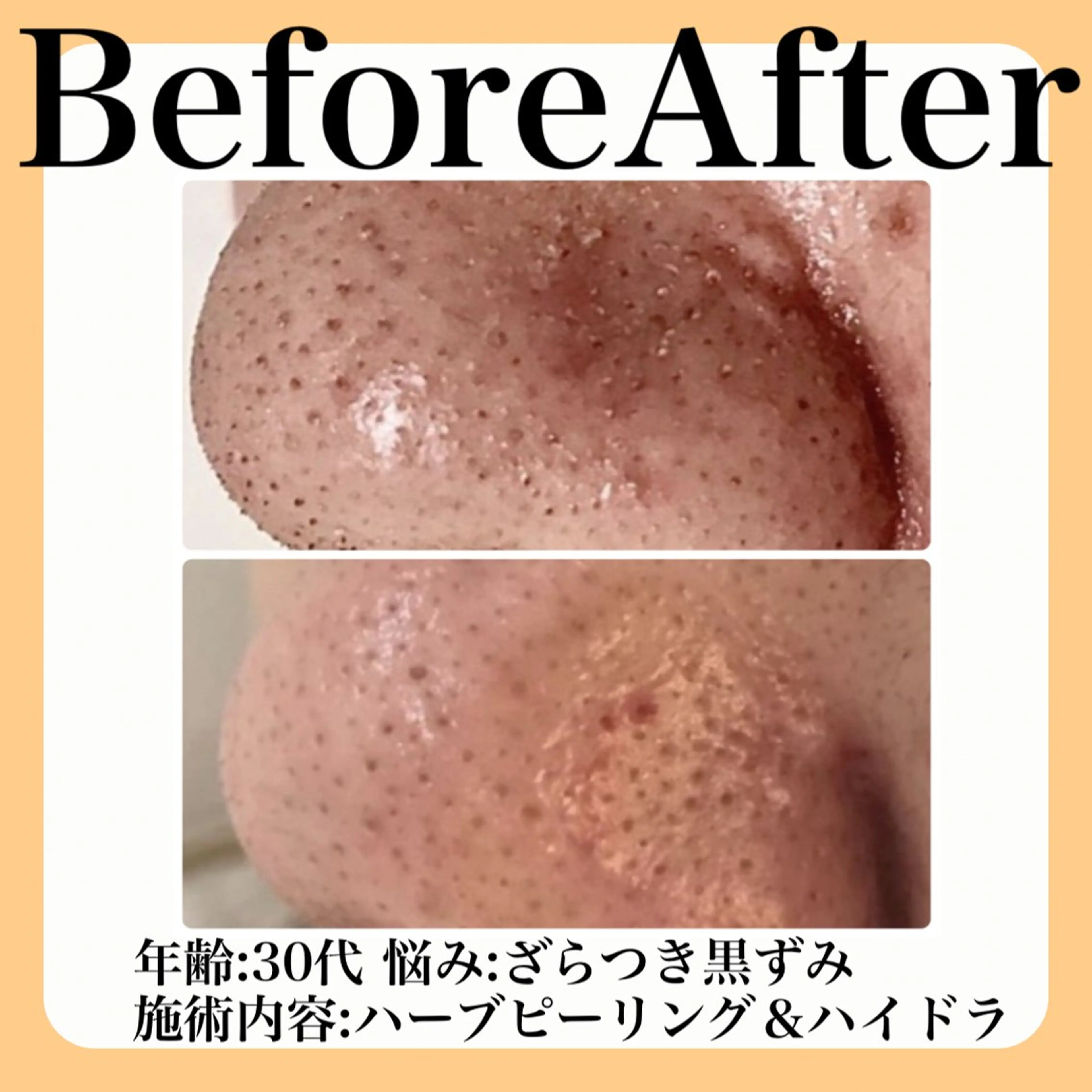 エステ 肌質改善 suiのエステ・リラクイメージ