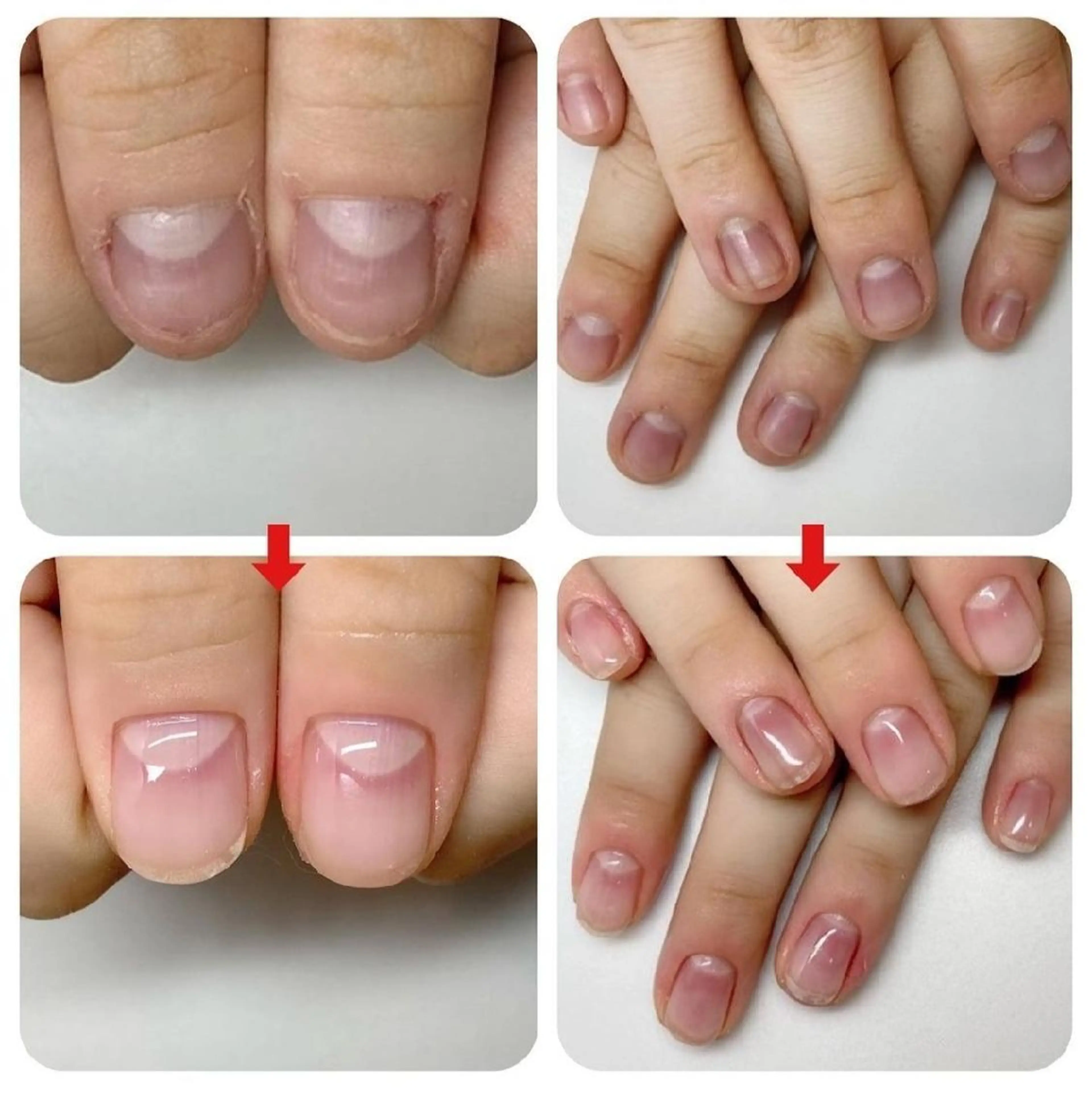 ネイル ネイルサロン アリュームのネイルデザイン