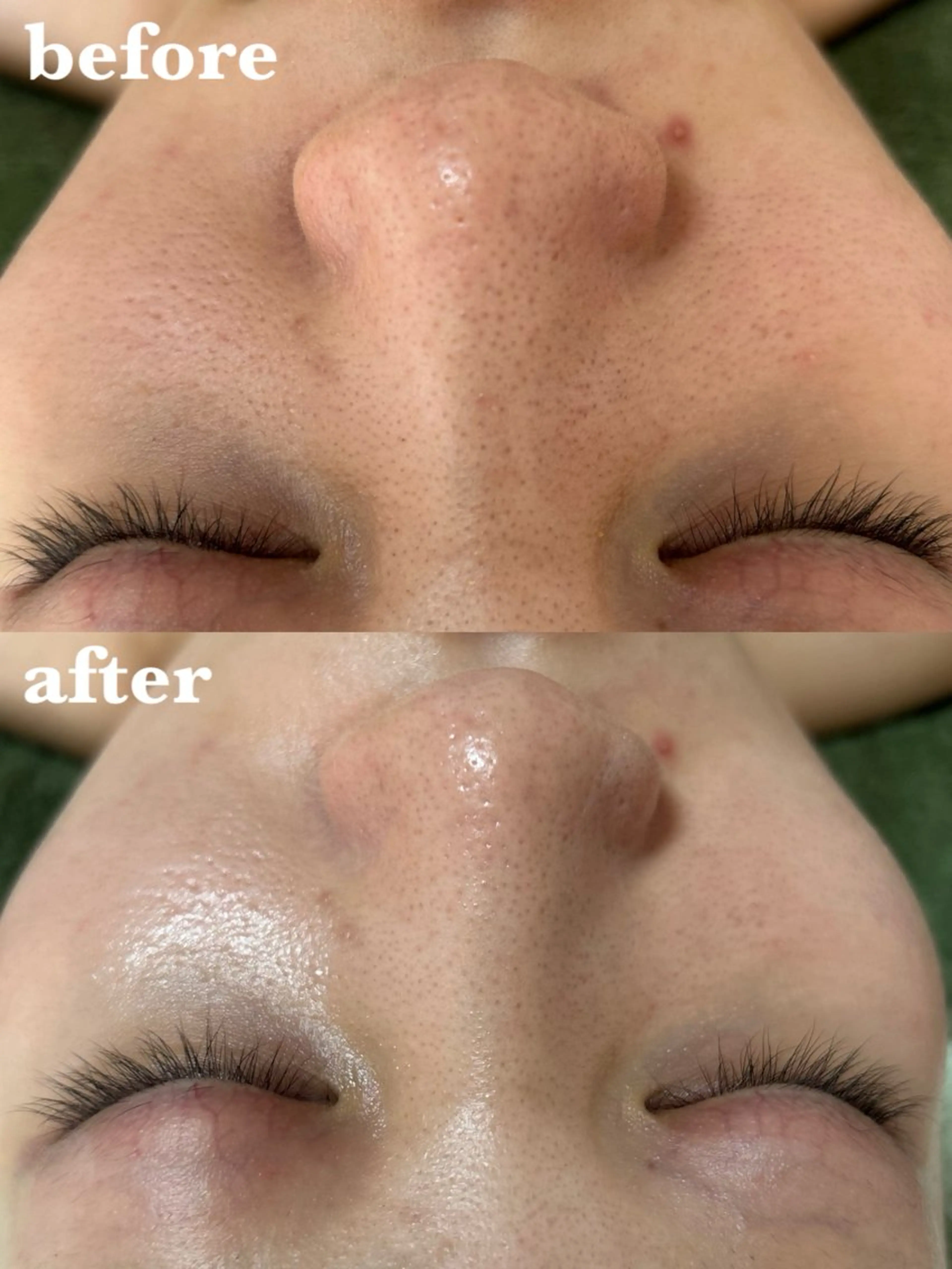 肌質改善＆脱毛 【M Mondo】のエステ・リラクイメージ