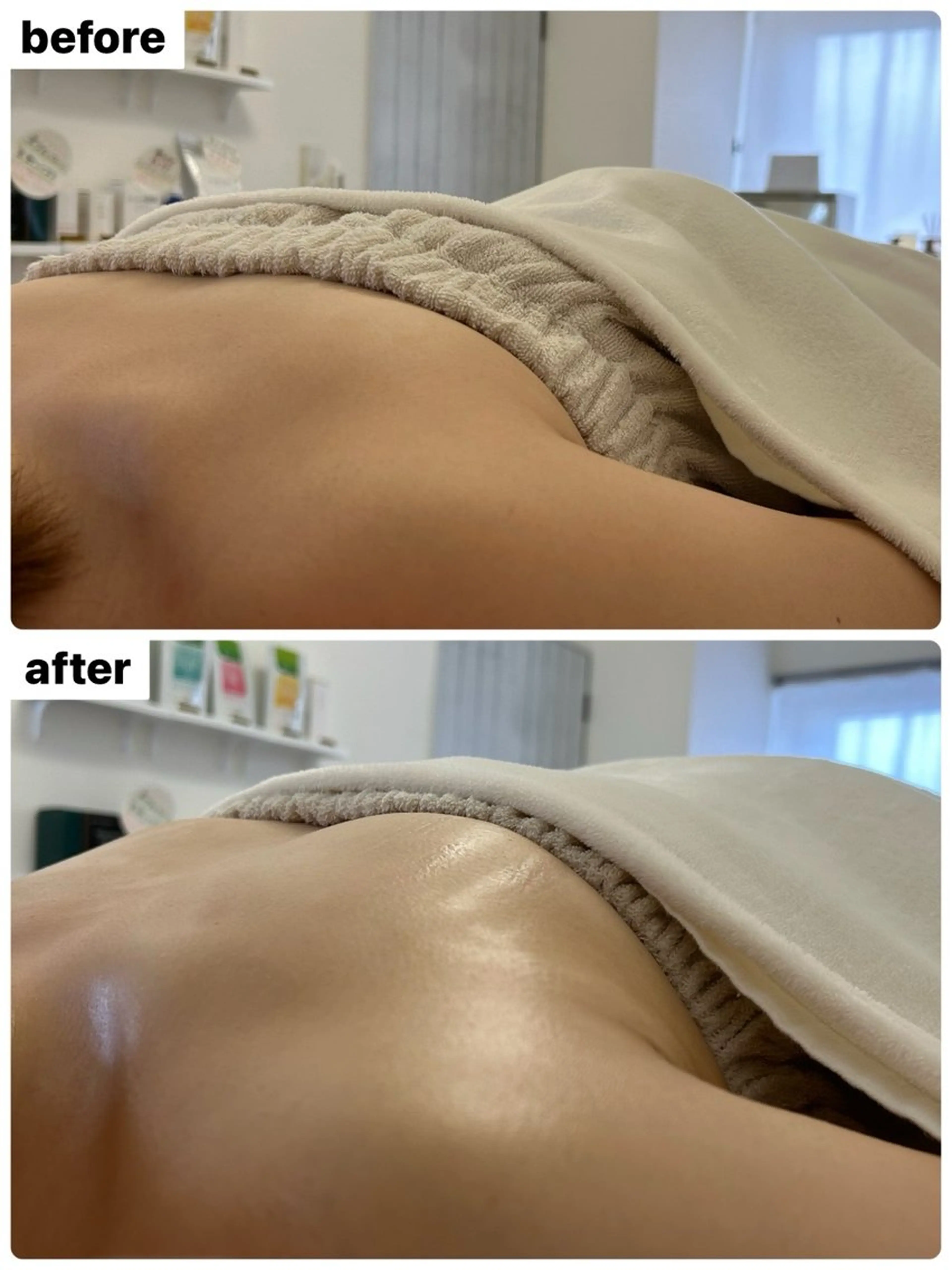 【バストの小ささにお悩み】ふっくら育乳70分￥8,800の写真