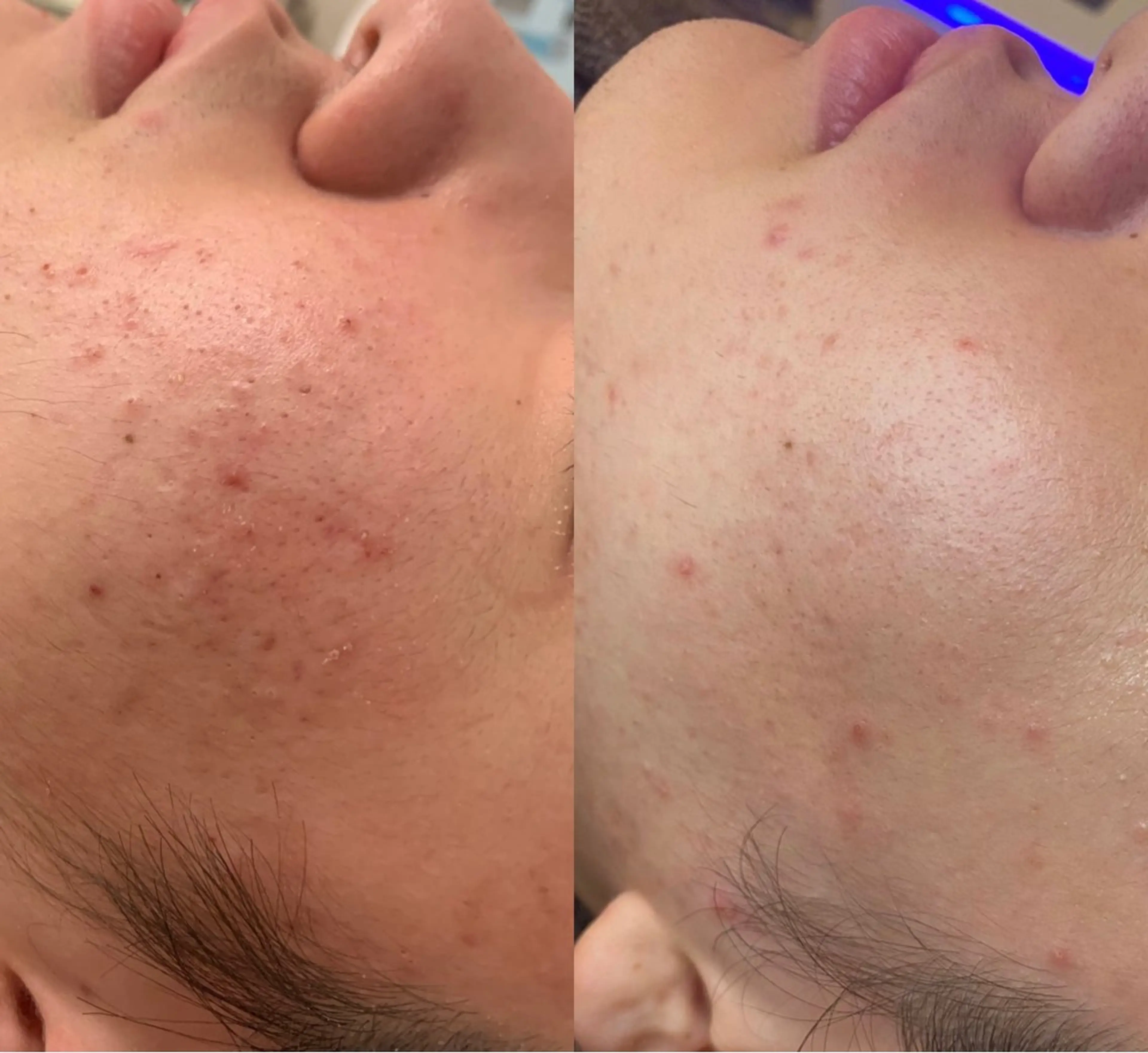 韓国肌管理ララピール クリスタルビューティのエステ・リラクイメージ