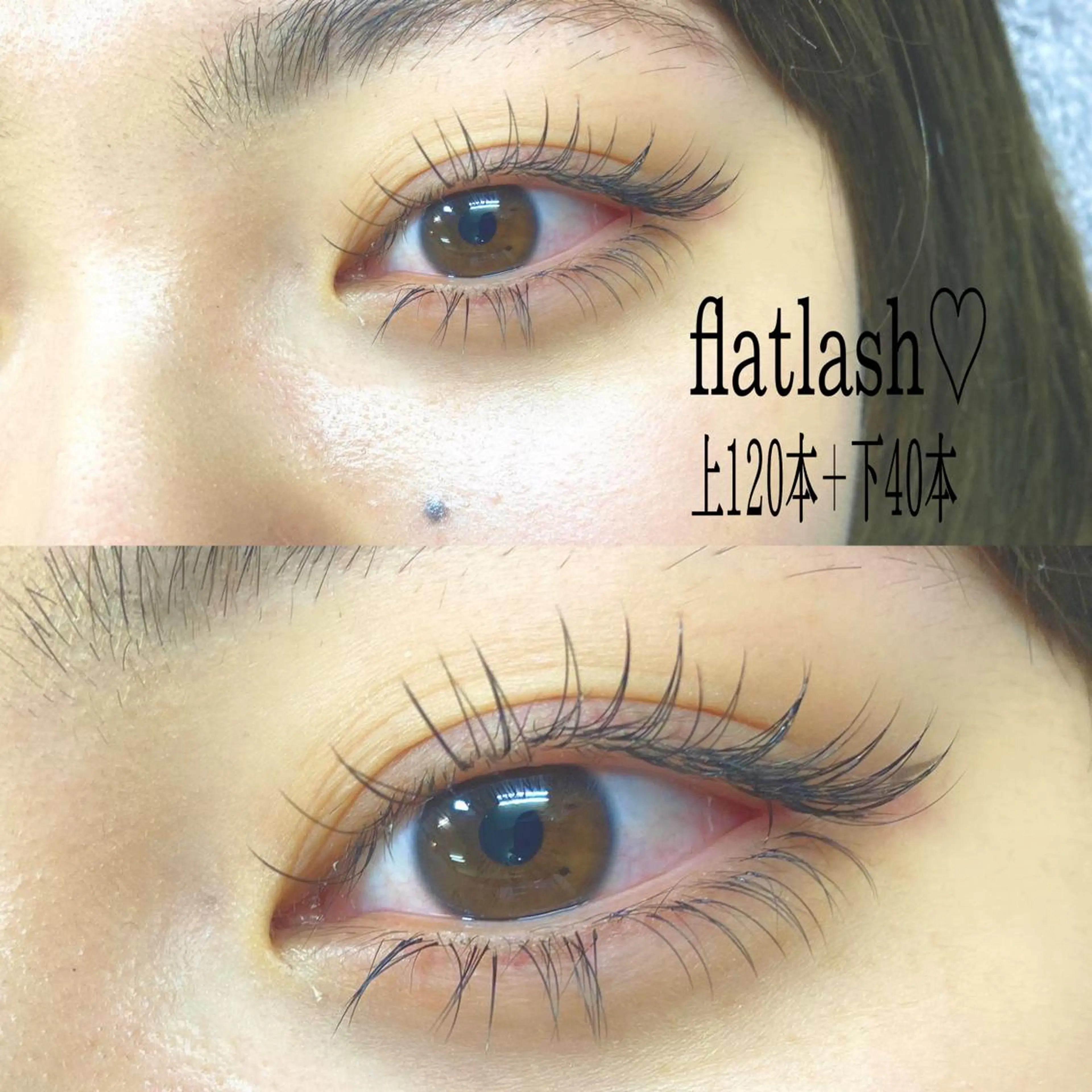 フラットラッシュ140本+下40本の写真