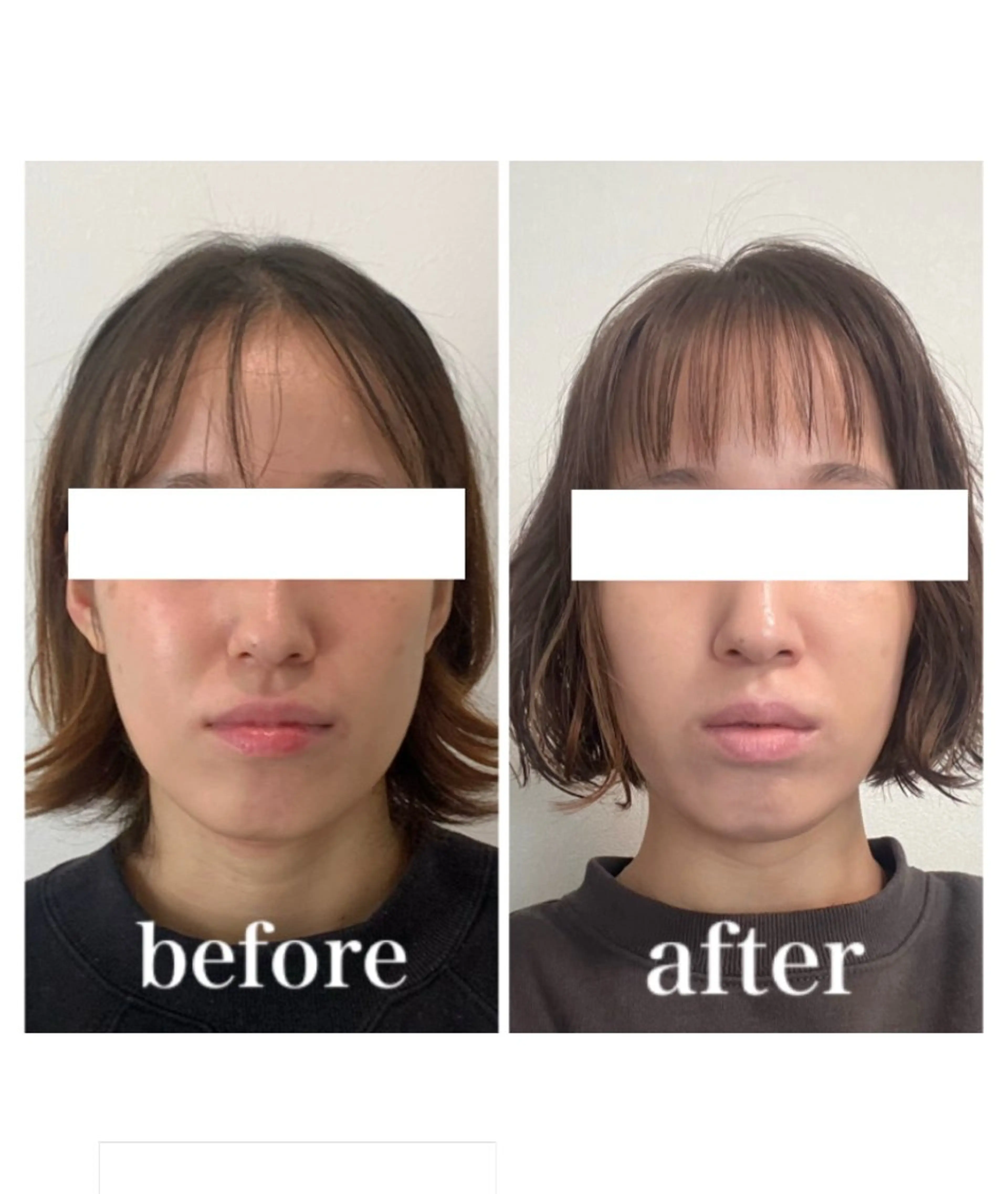 エステ リラク 小顔と ヘッドスパのお店のエステ・リラクイメージ