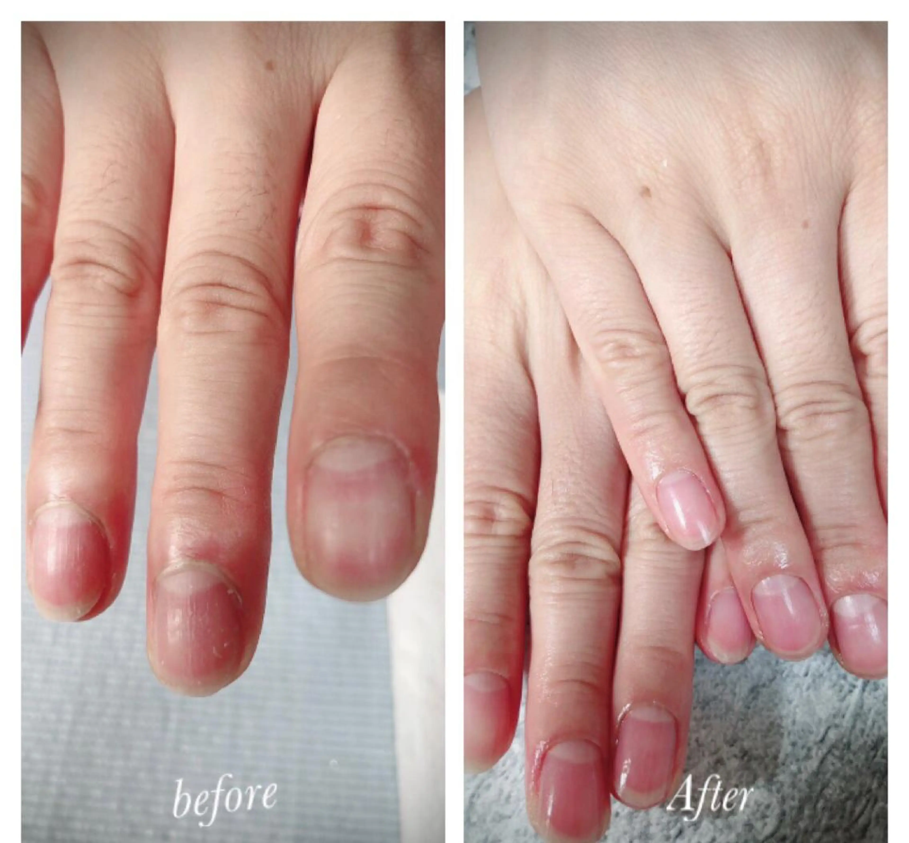 ネイル 北浦和 自爪育成ケアのネイルデザイン