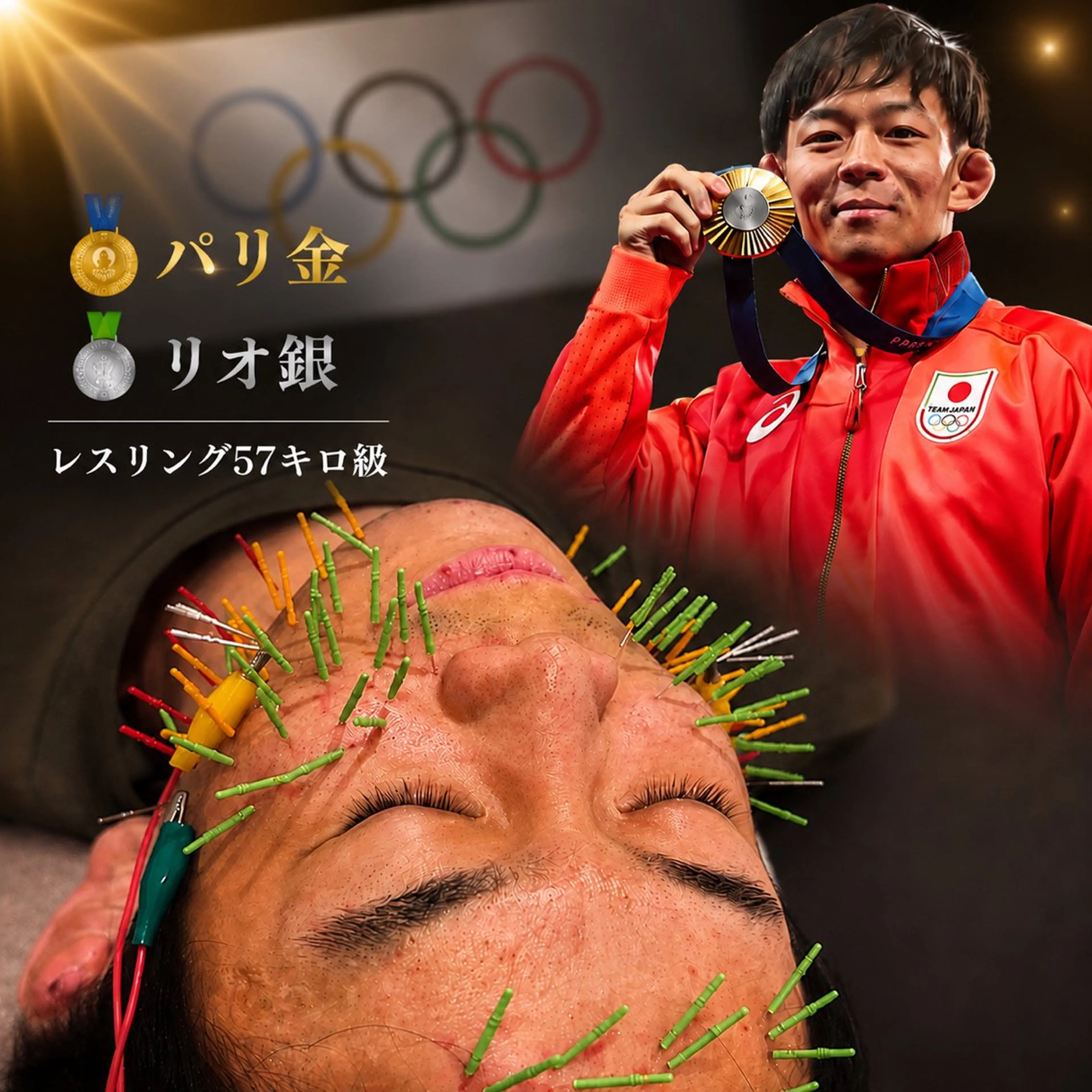 メンズ エステ リラク 肌質改善×美容鍼 ゆいのエステ・リラクイメージ