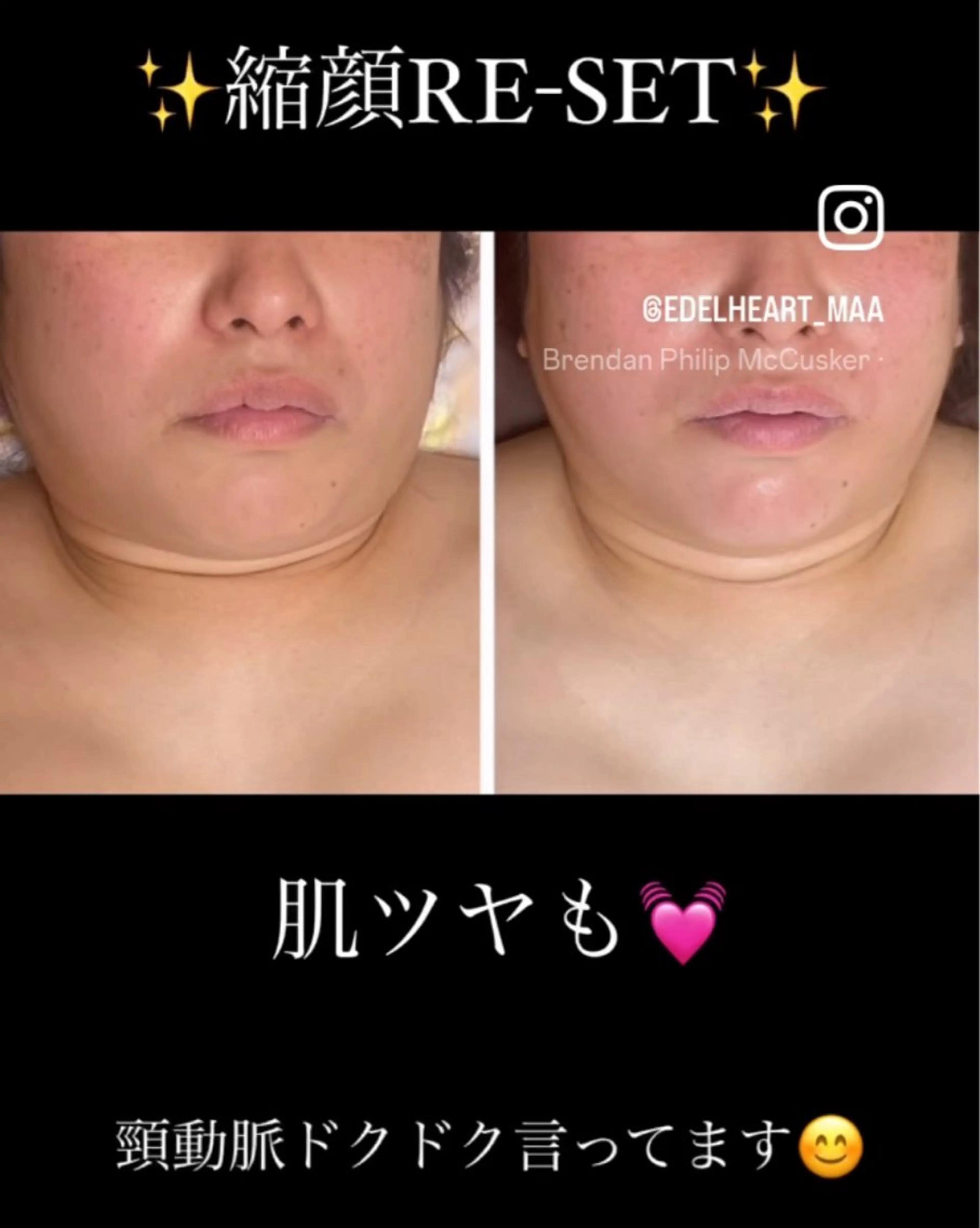 その他 金納 まゆみのエステ・リラクイメージ