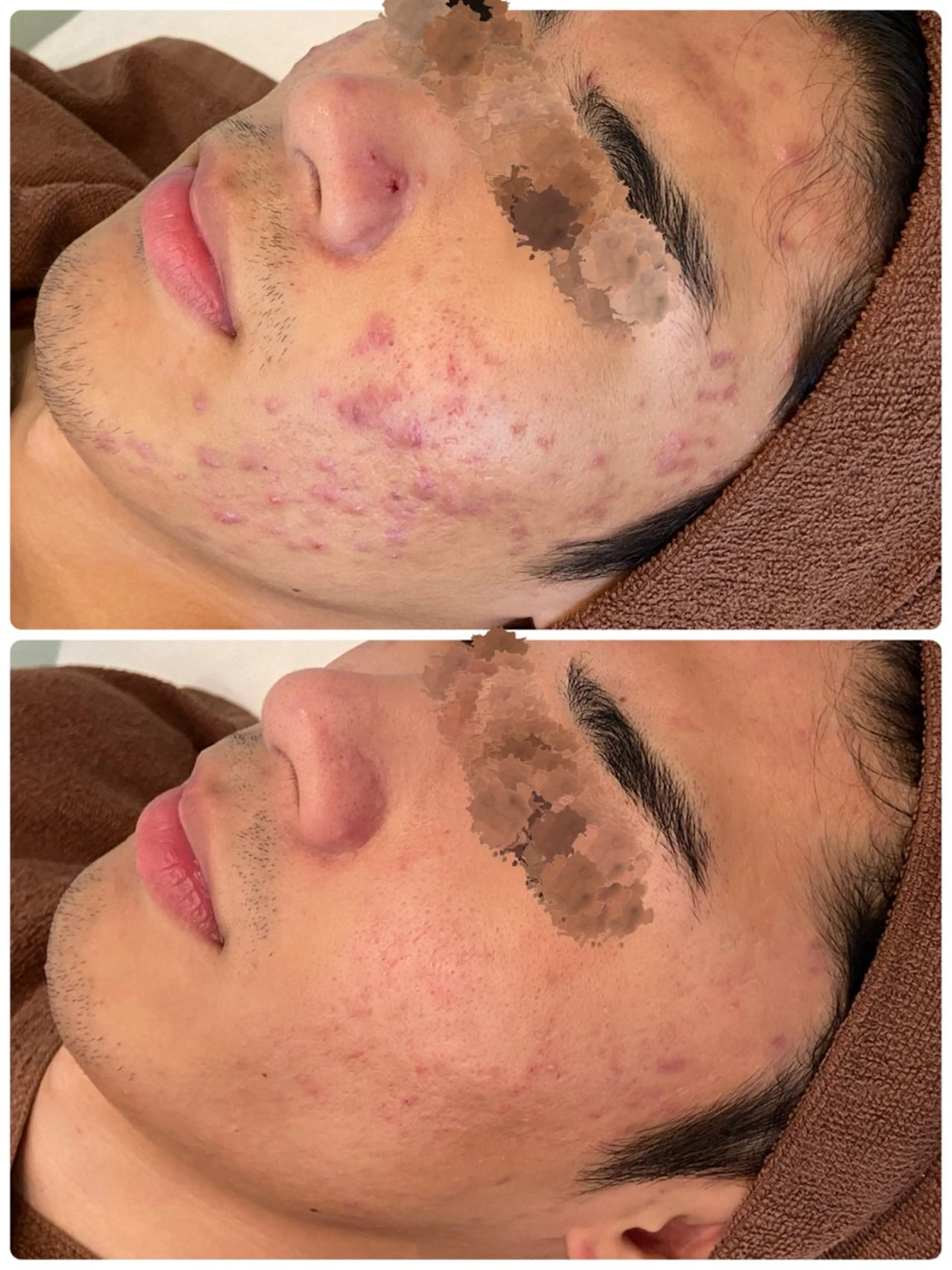 ハーブピーリング専門 BIOPLUS＋川崎のエステ・リラクイメージ