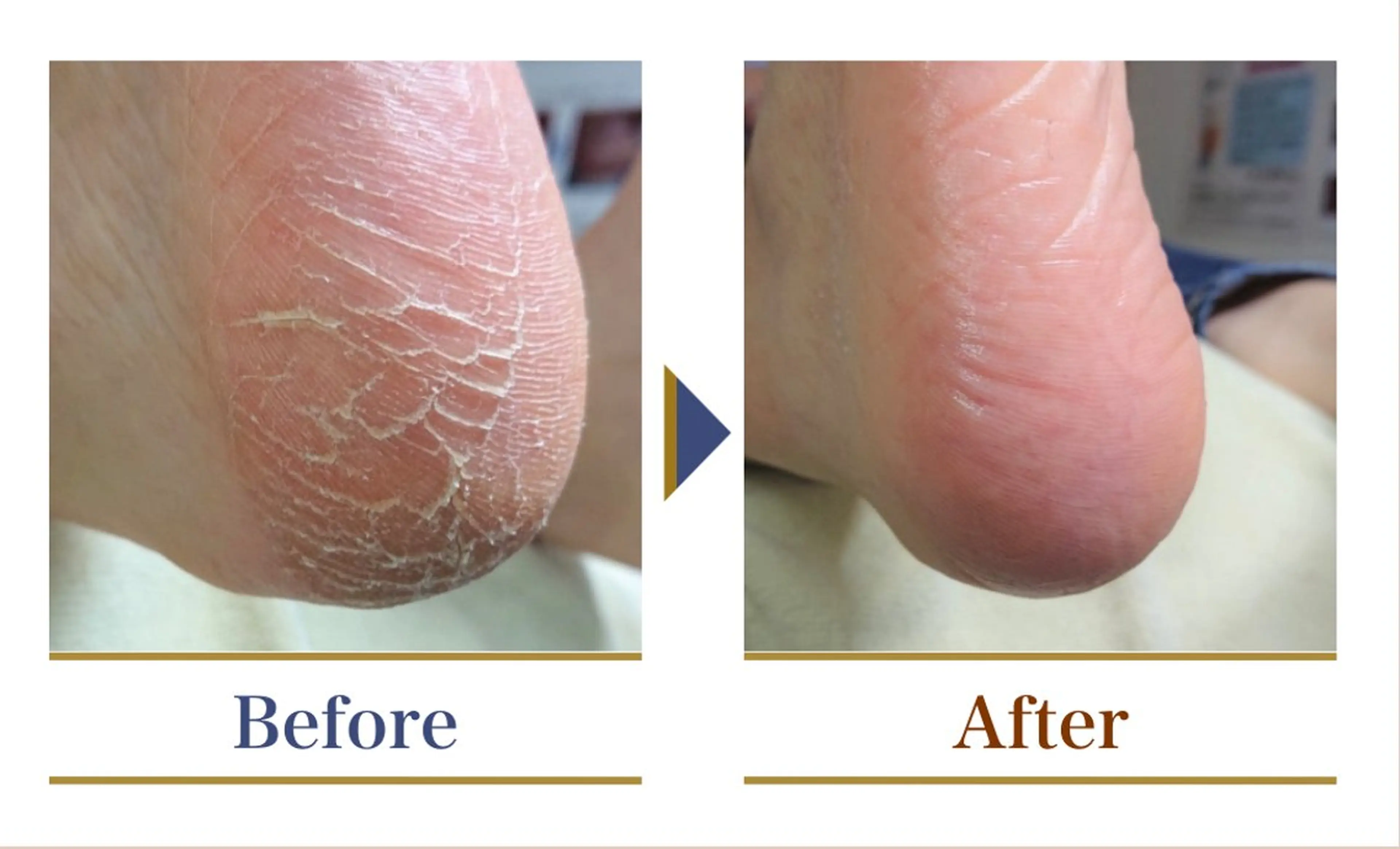 巻き爪補正店 横浜関内店のネイルデザイン