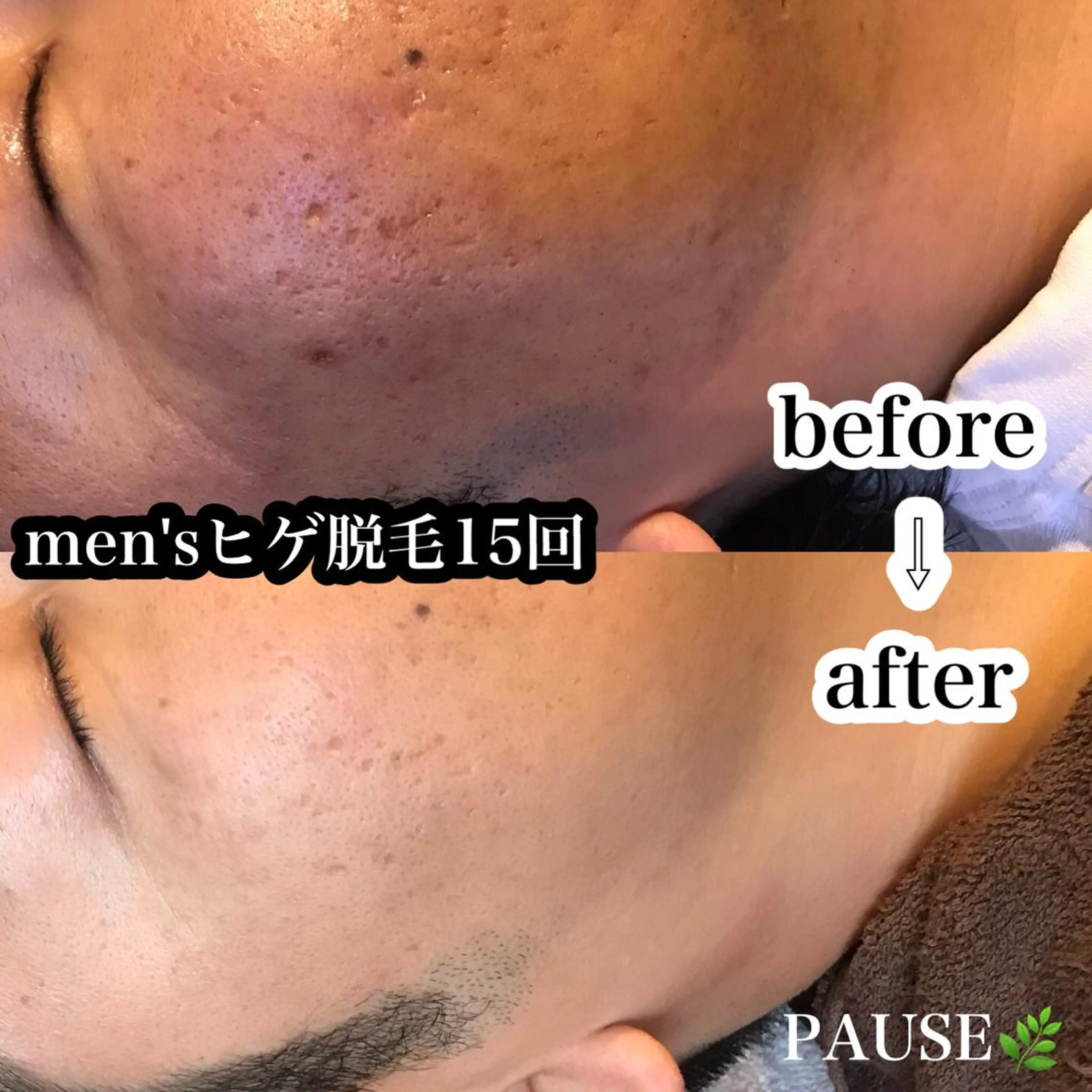 脱毛 浜野 恵美のエステ・リラクイメージ