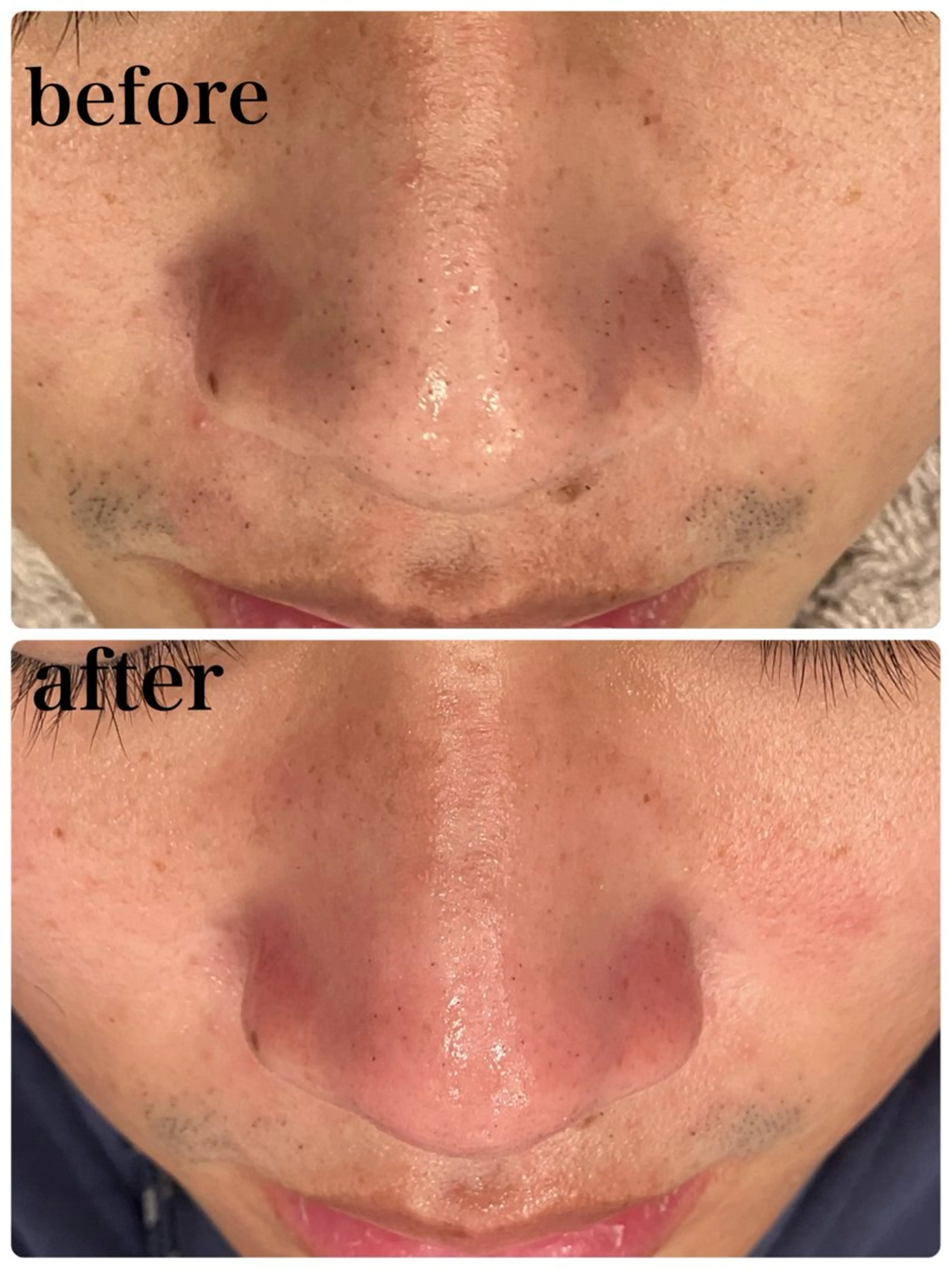 その他 infinity所属・Infinity KAYOのその他イメージ