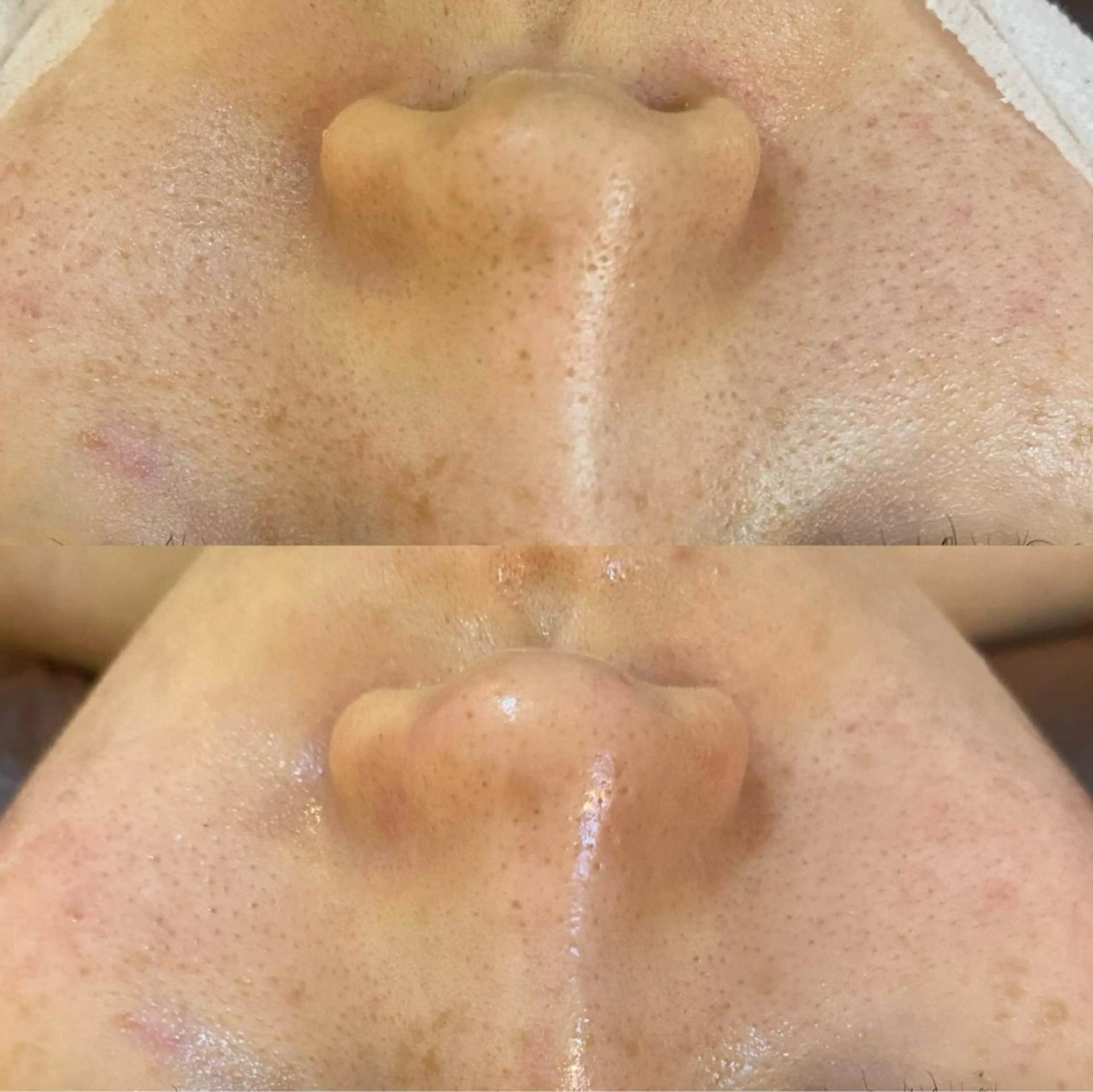 BELCIA福岡店 レコルトデベルシアのエステ・リラクイメージ