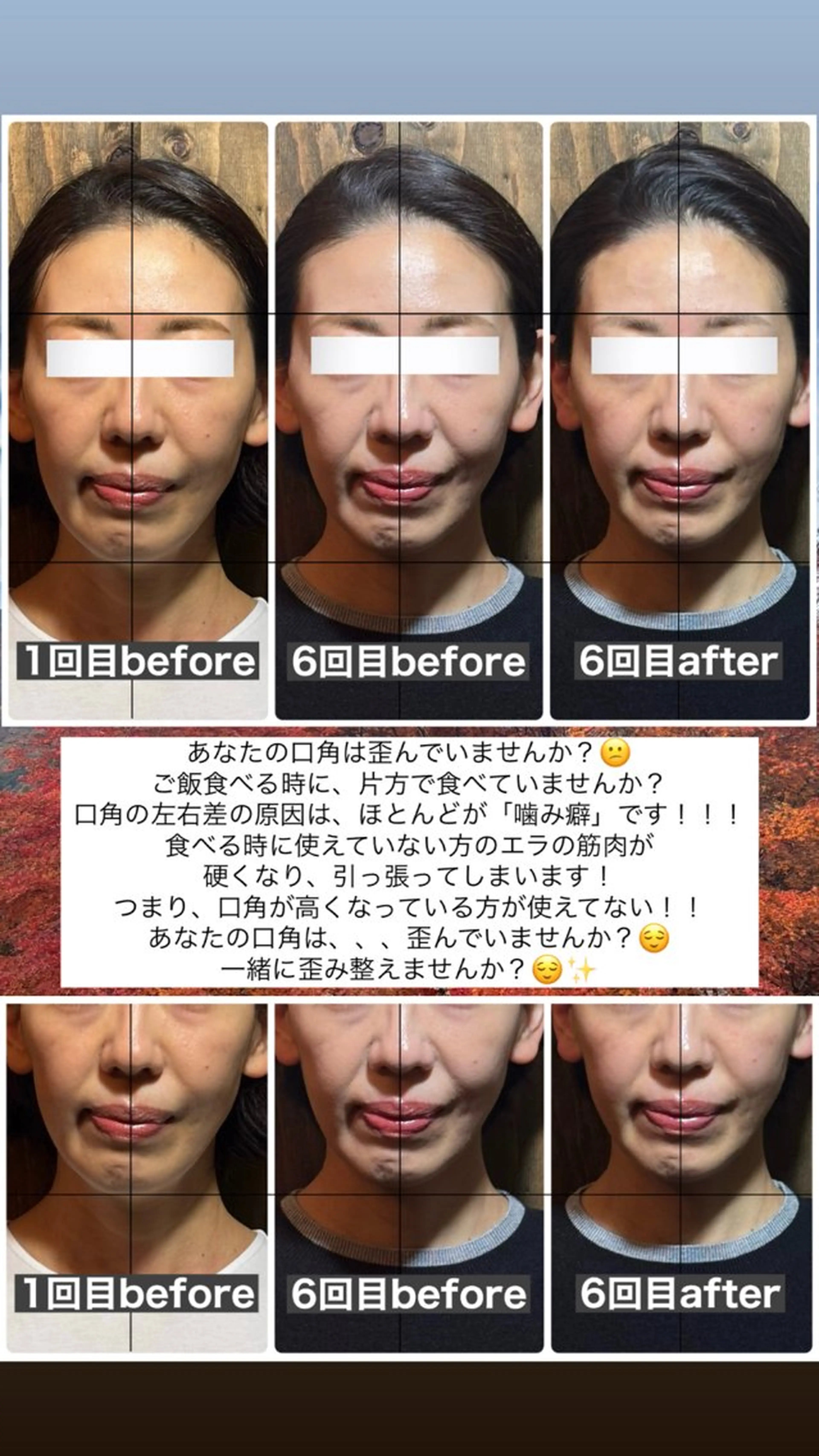 エステ リラク 💎後悔させない小顔 矯正💎イトヤマ🌱のエステ・リラクイメージ