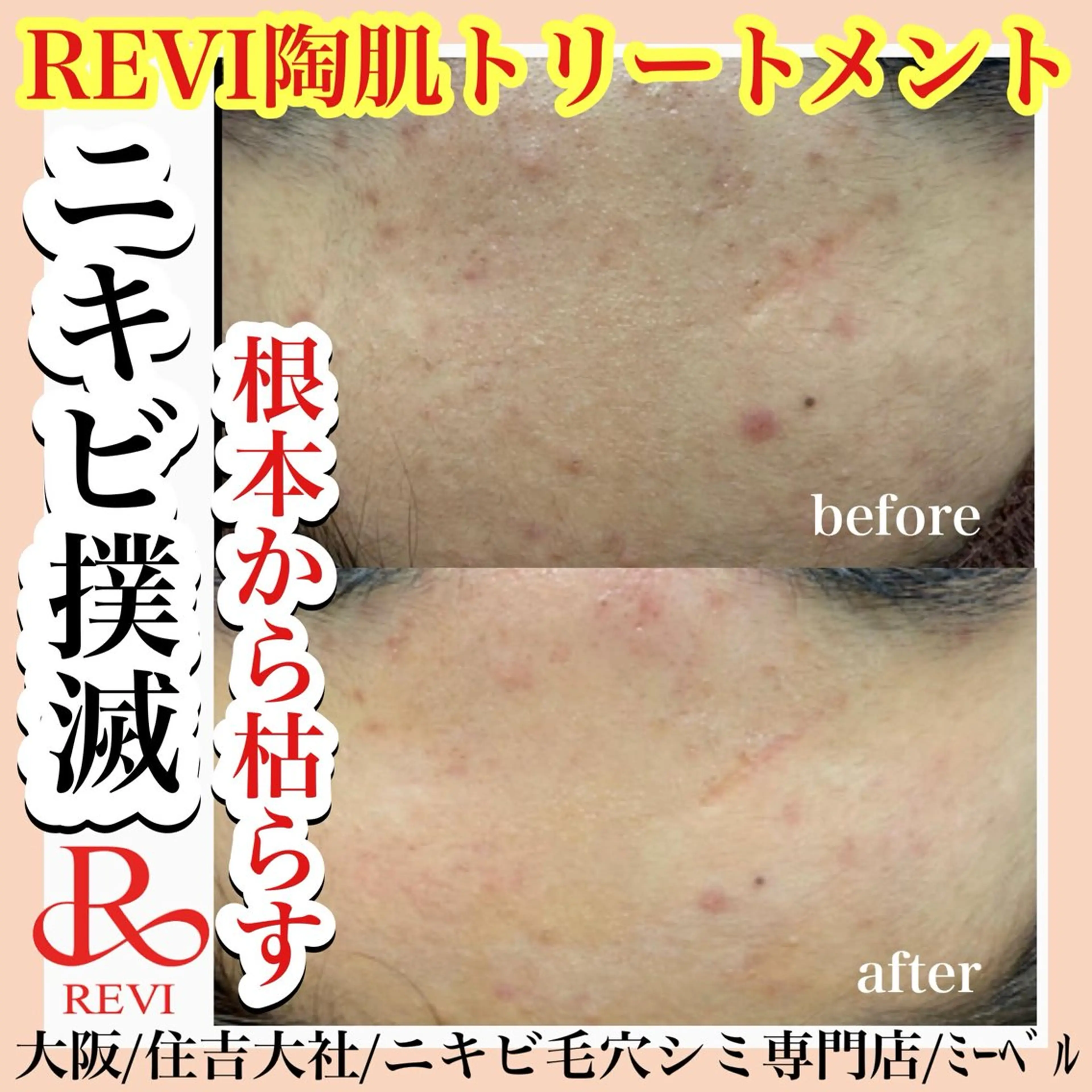 salon  mebell所属・肌管理専門店 mebell天王寺店のエステ・リラクイメージ