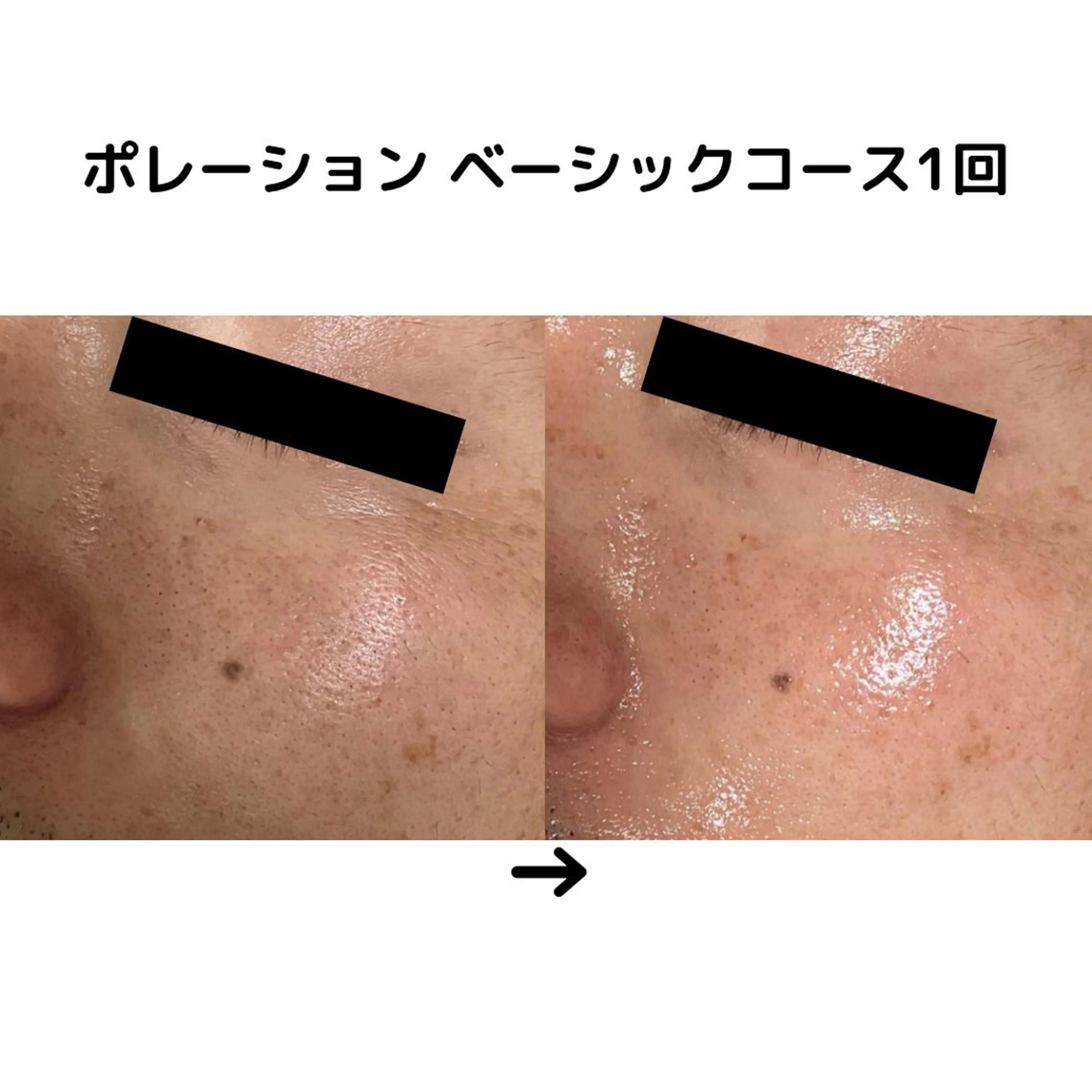 ミューズエステ 谷口美結のエステ・リラクイメージ