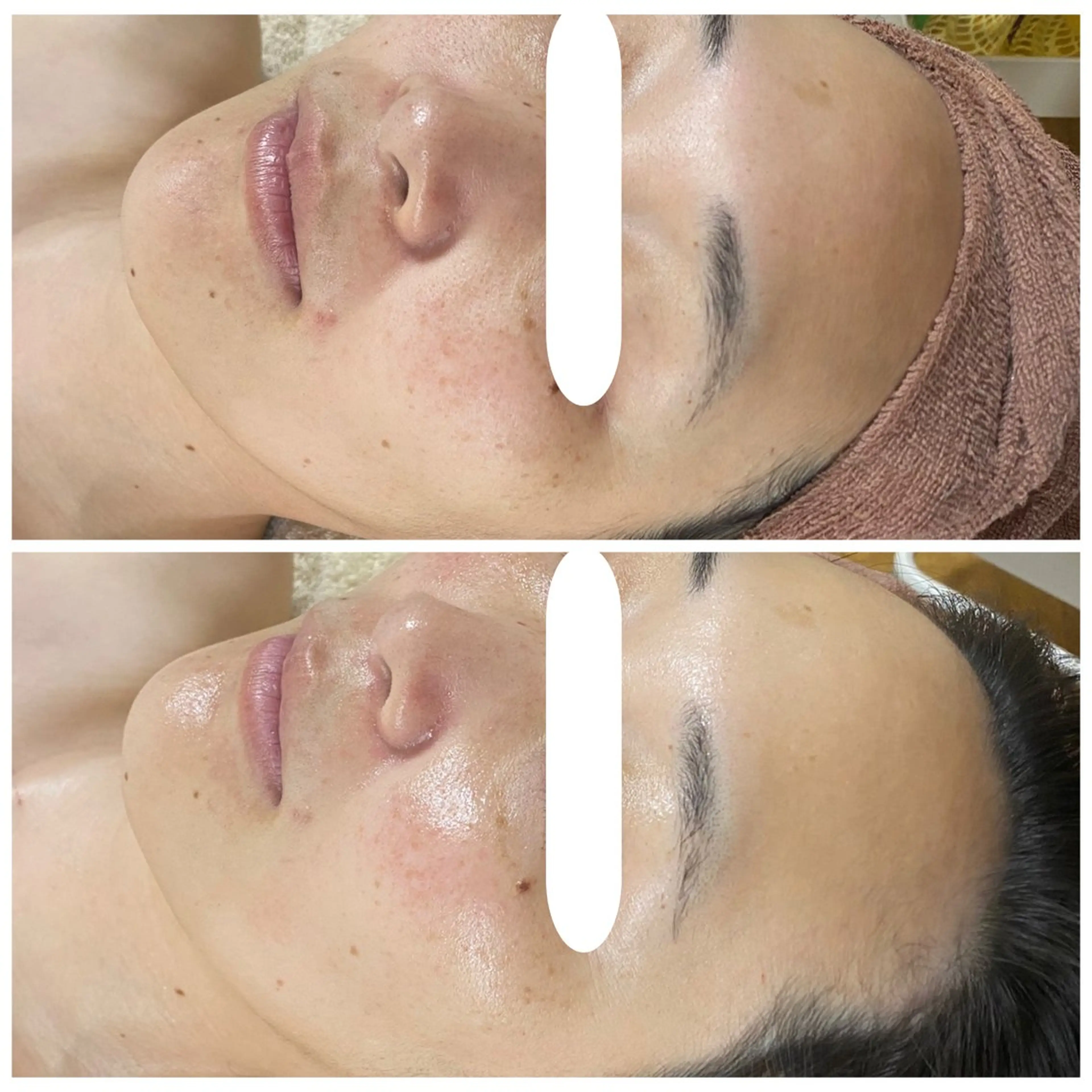 エステ Linoa所属・Linoa(リノア) エステ&リラクのエステ・リラクイメージ