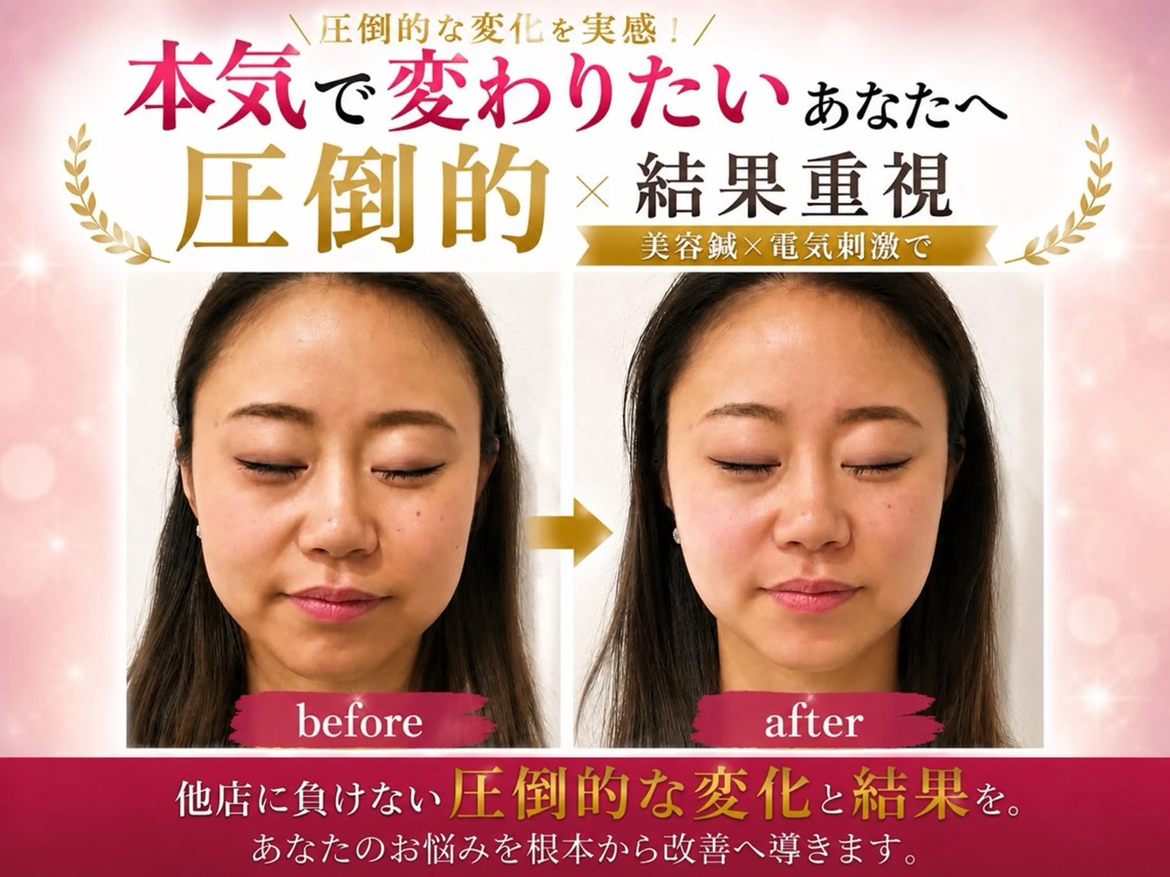 エステ リラク 肌質改善×美容鍼 ゆいのエステ・リラクイメージ