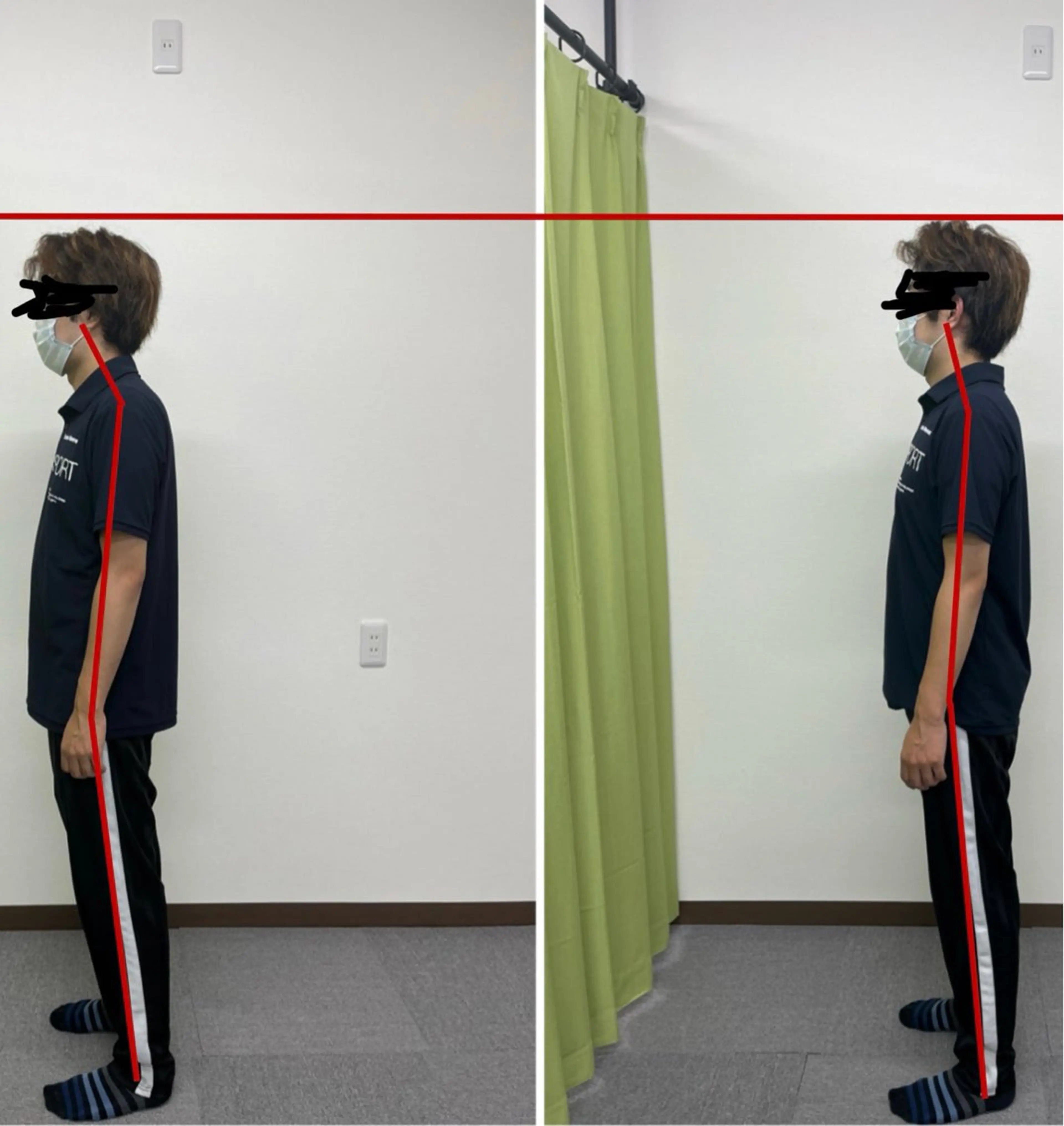 当店オススメ❗️腰痛、肩こり、ストレートネック、姿勢改善の方にオススメ☆もみほぐし＋ストレッチ75分¥5000の写真