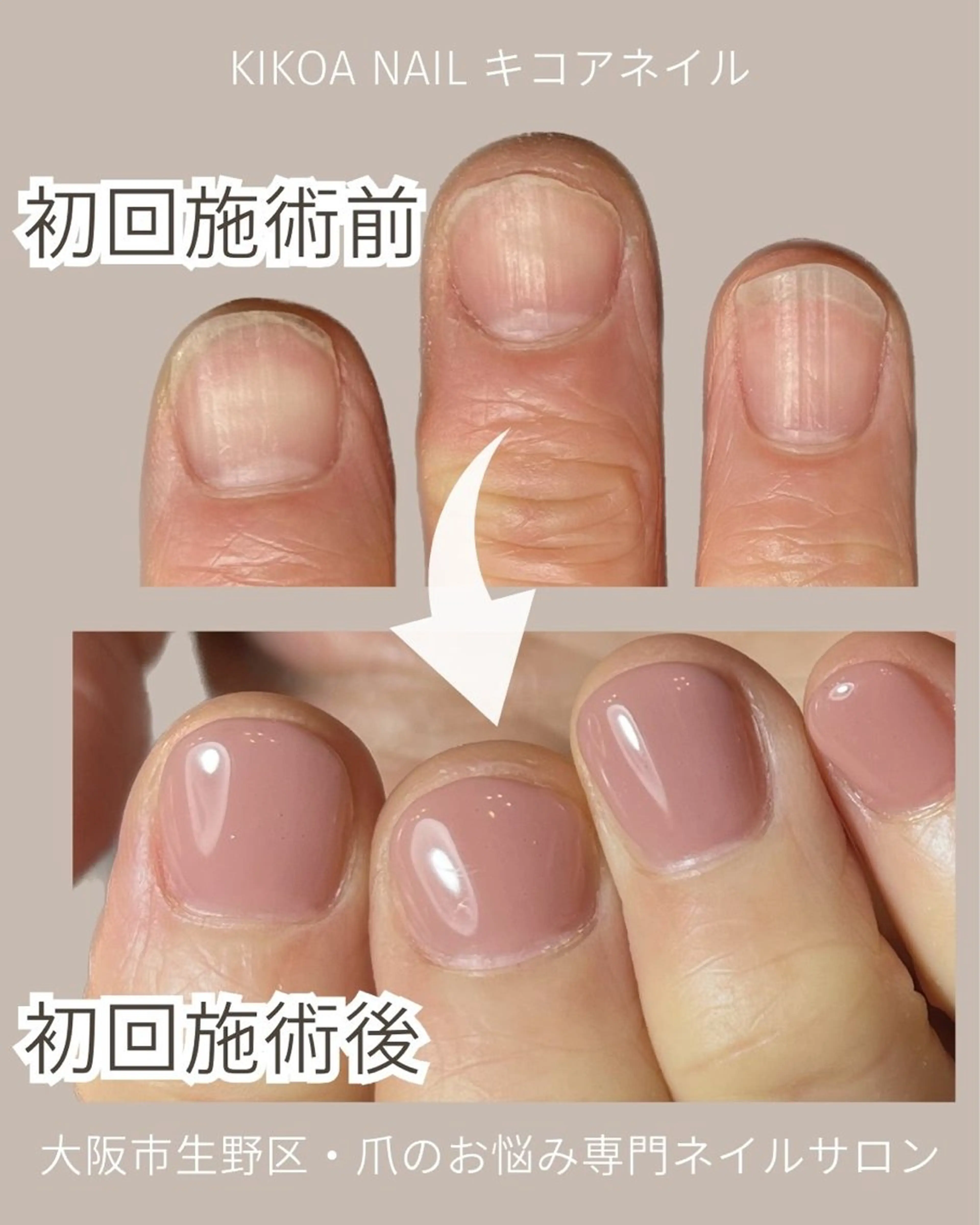 ネイル KIKOA NAIL キコアネイルのネイルデザイン