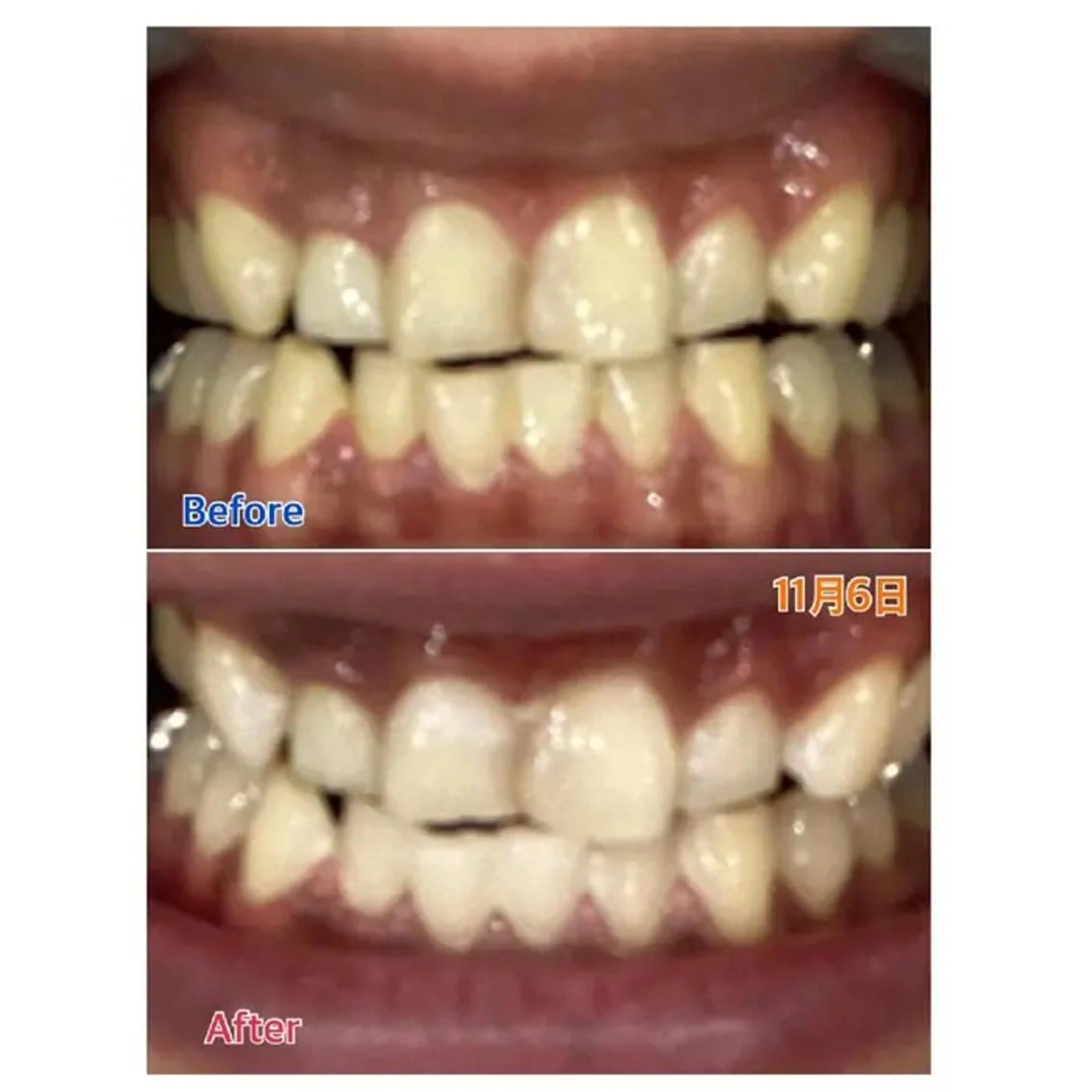 M渋谷 ホワイトニングのその他イメージ