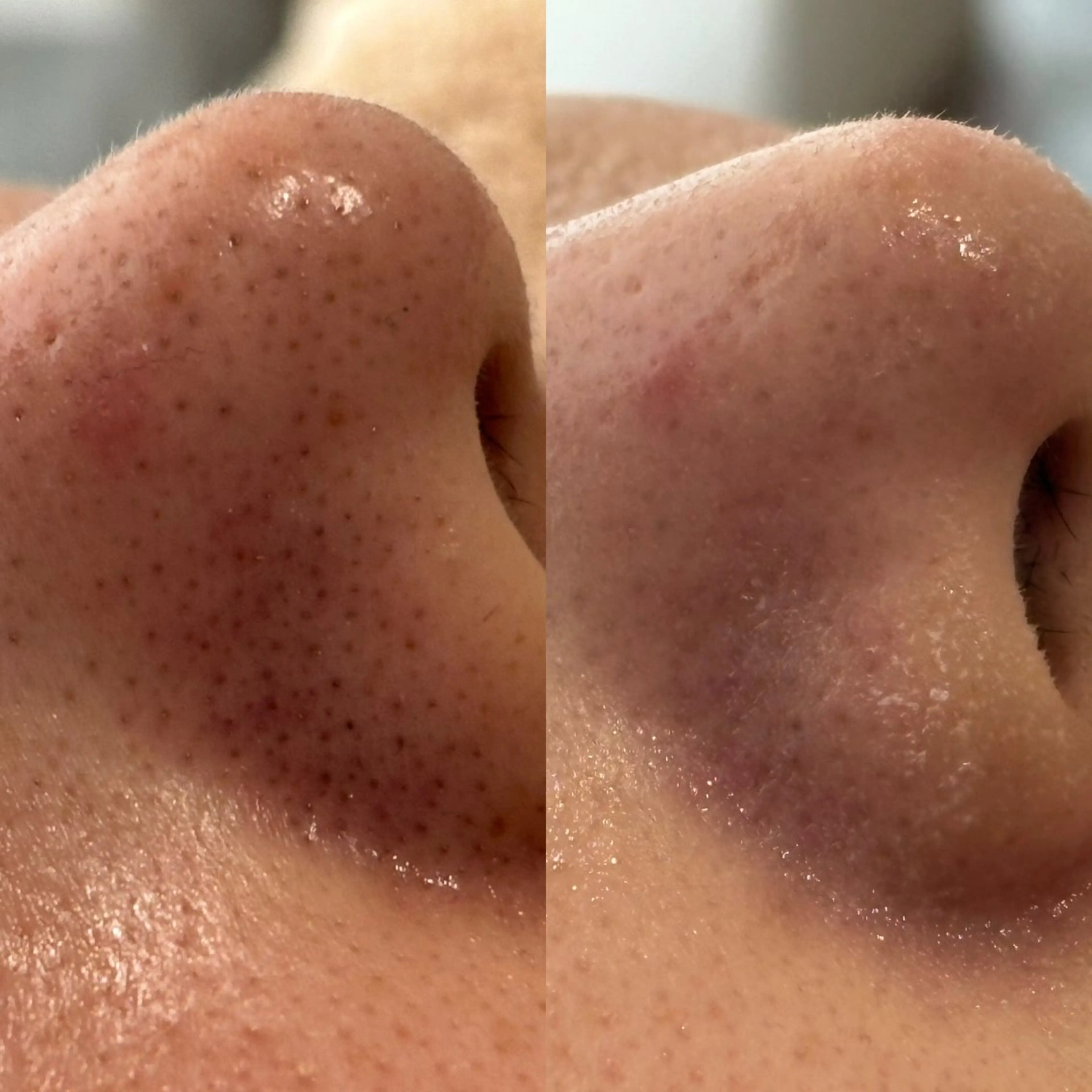 mili mili 岡本のエステ・リラクイメージ