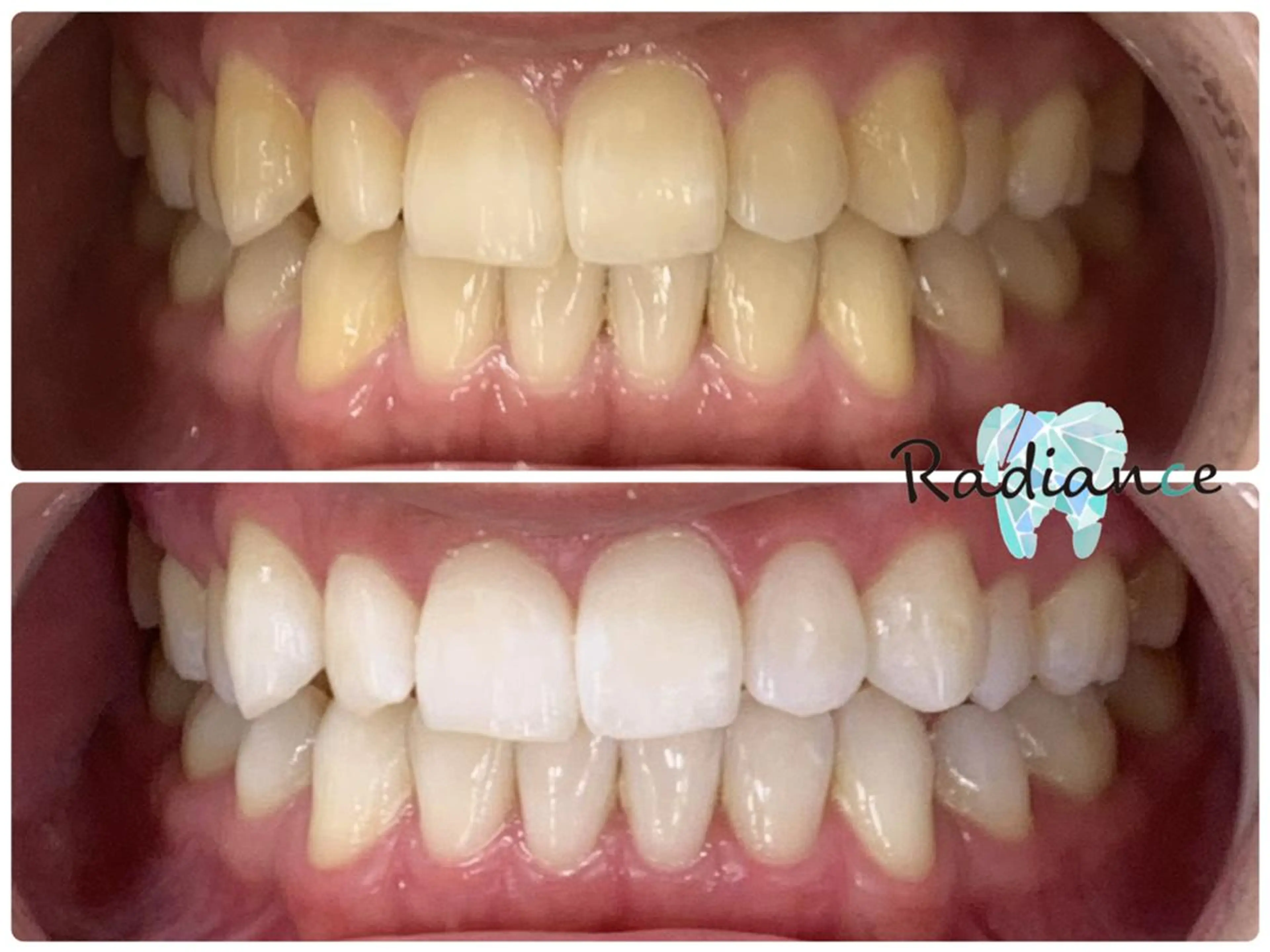 札幌ホワイトニング ラディアンス菊水店のその他イメージ