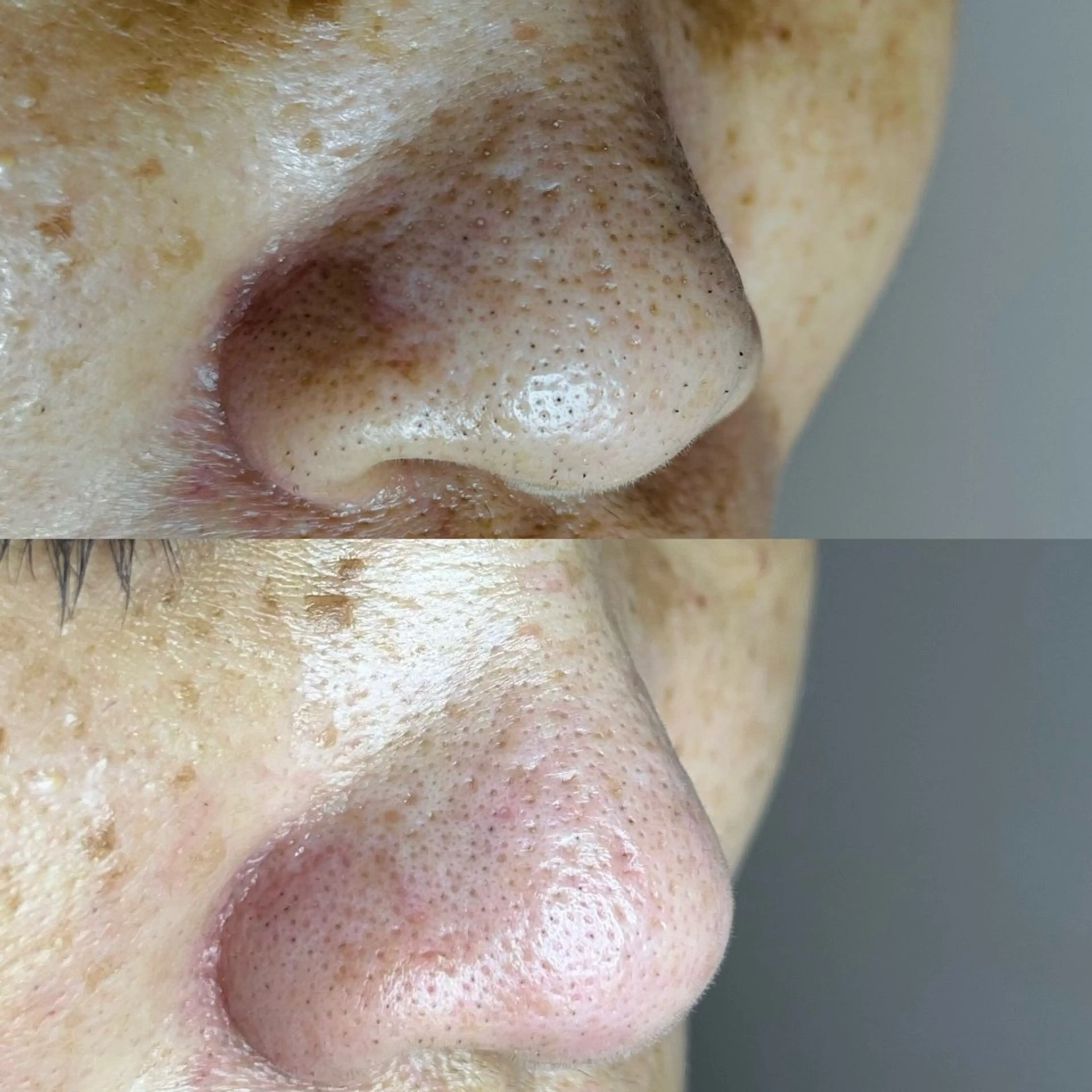 毛穴ケア・ヘッドスパ サロンSHINYのエステ・リラクイメージ