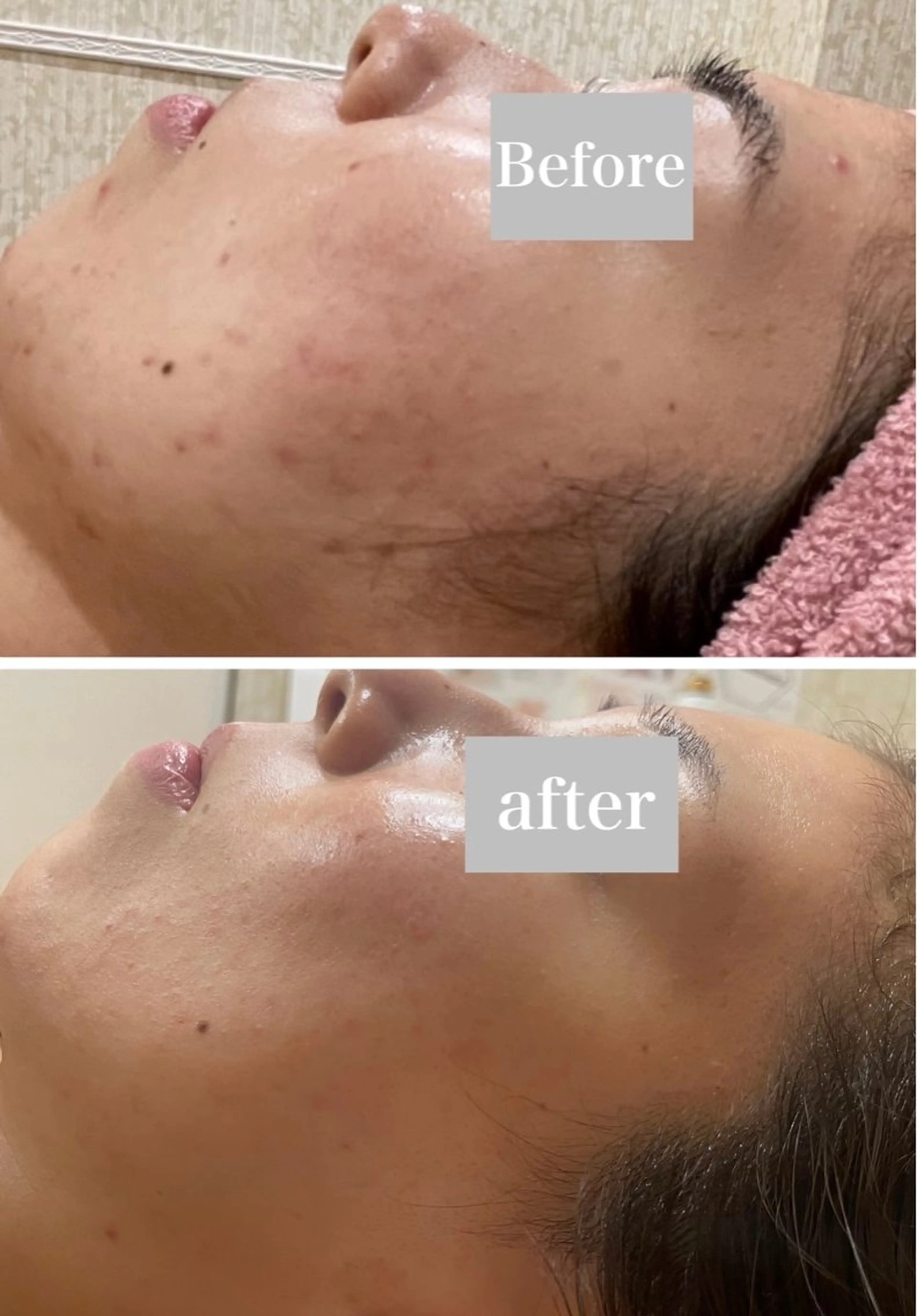 エステ矢野 ジョアアンジェ心斎橋のエステ・リラクイメージ