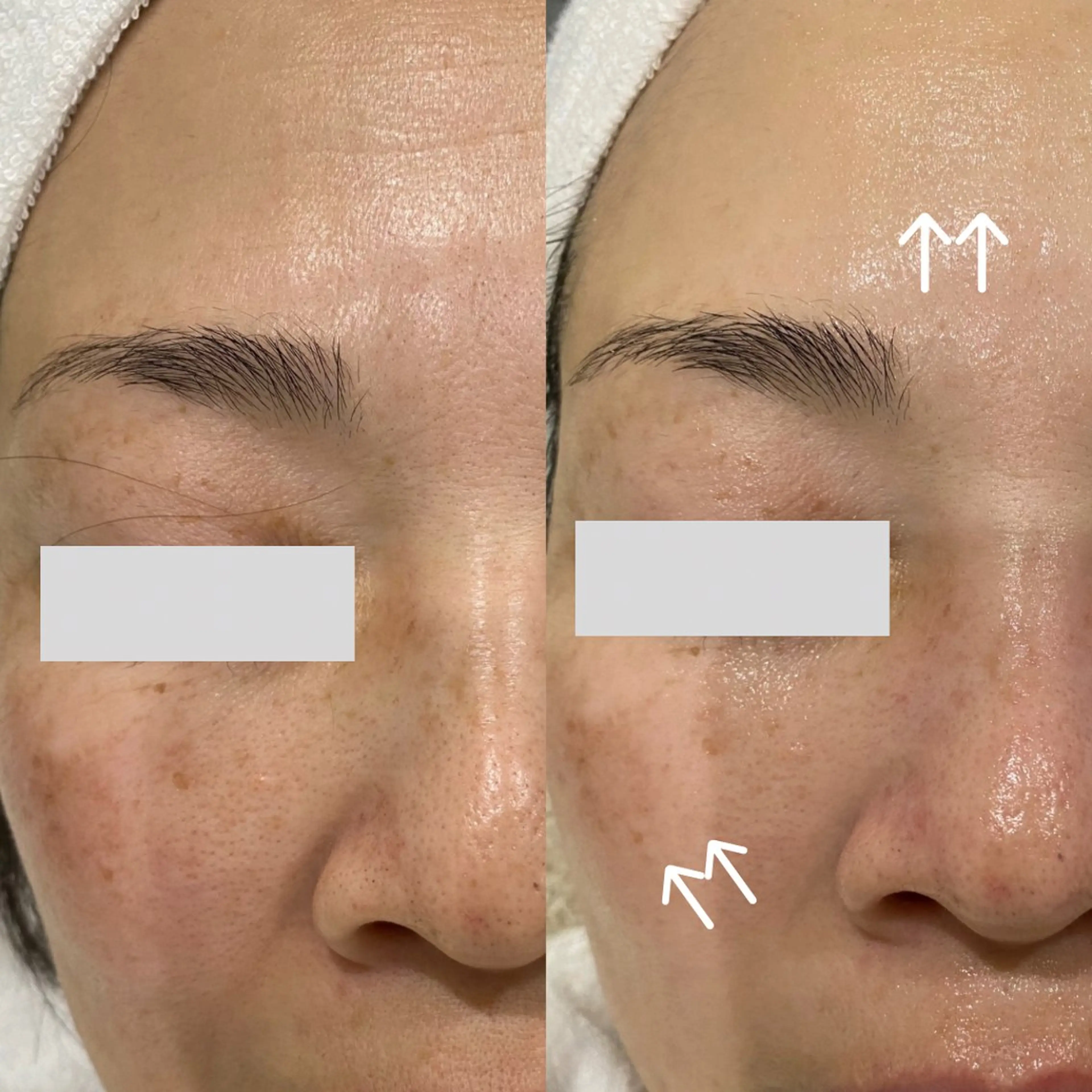 エステ Del'm豊橋所属・豊橋De'Im 安部のエステ・リラクイメージ