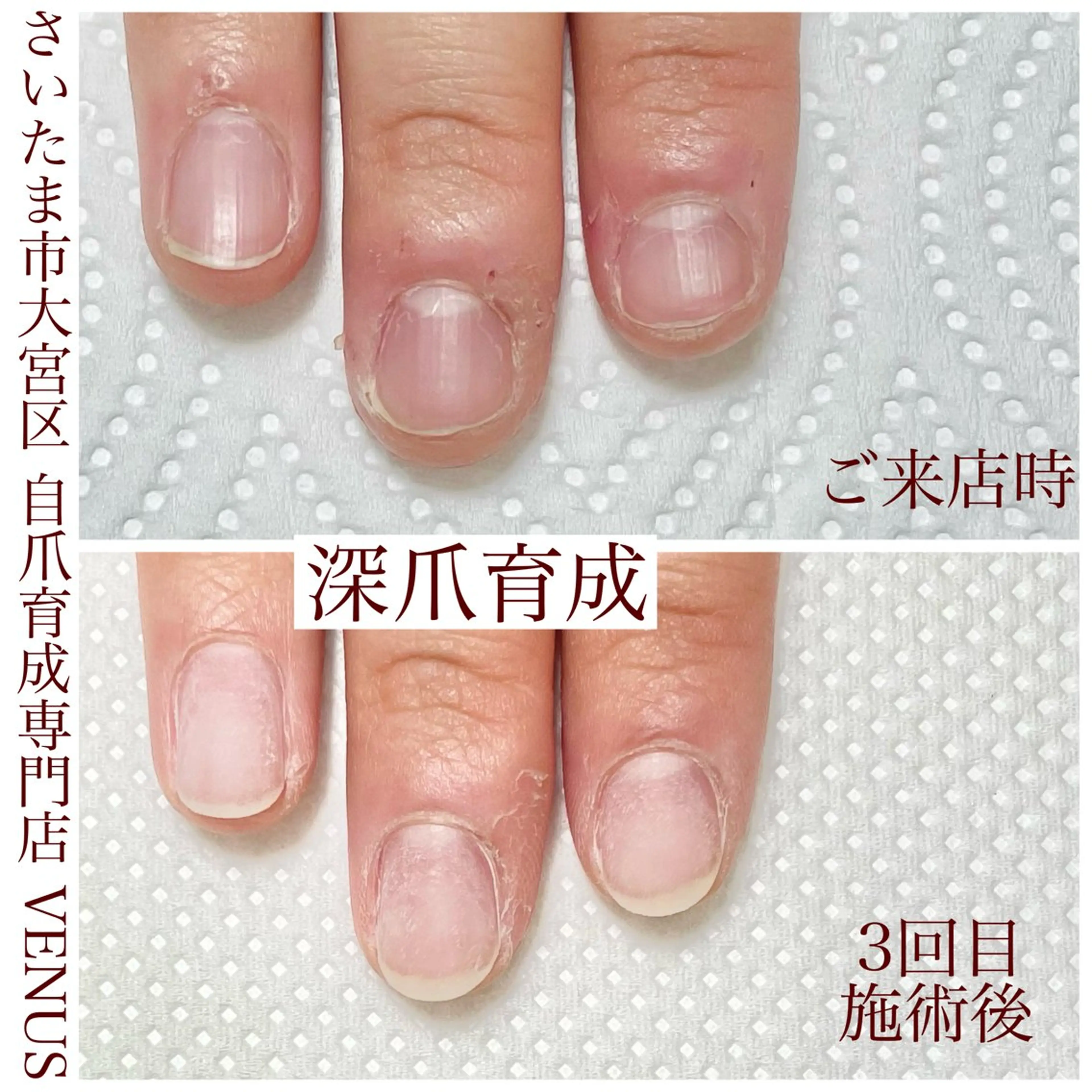 ネイル ハンドネイル ハンドケア nailsalon VENUSのネイルデザイン