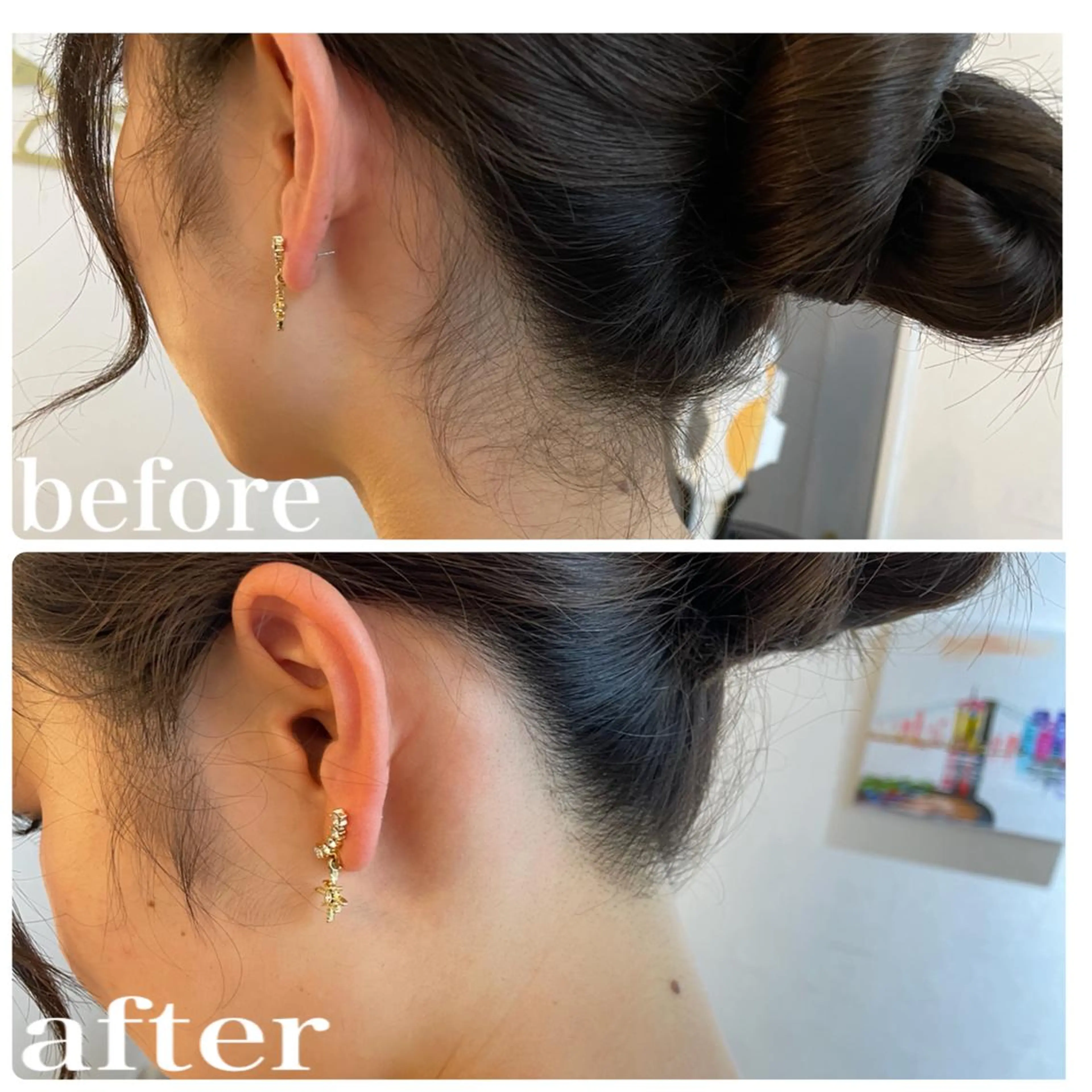 うなじ脱毛/美肌脱毛 LABELのエステ・リラクイメージ