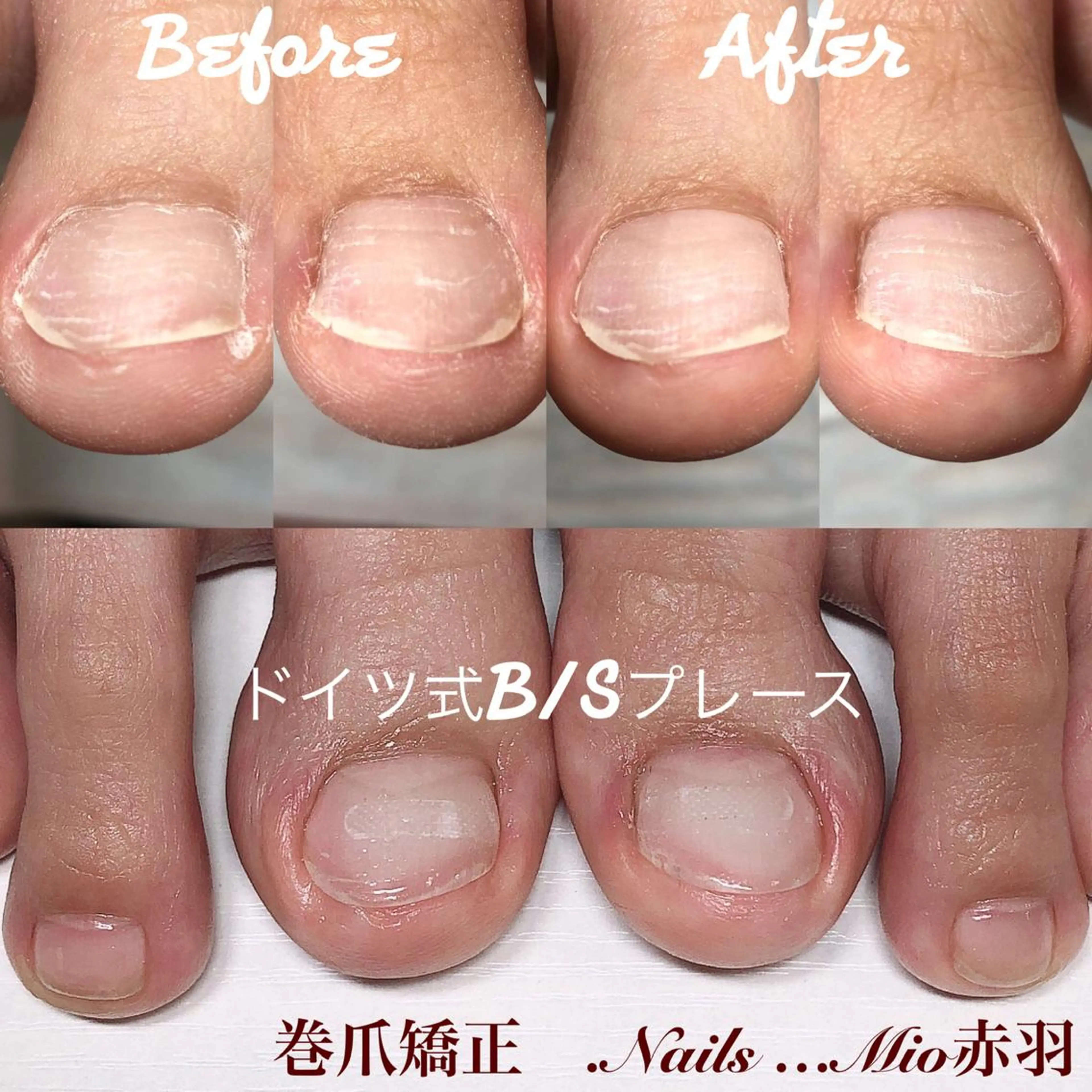 ネイル フットネイル フットネイル .Nails Mio 赤羽西ネイルサロンのネイルデザイン
