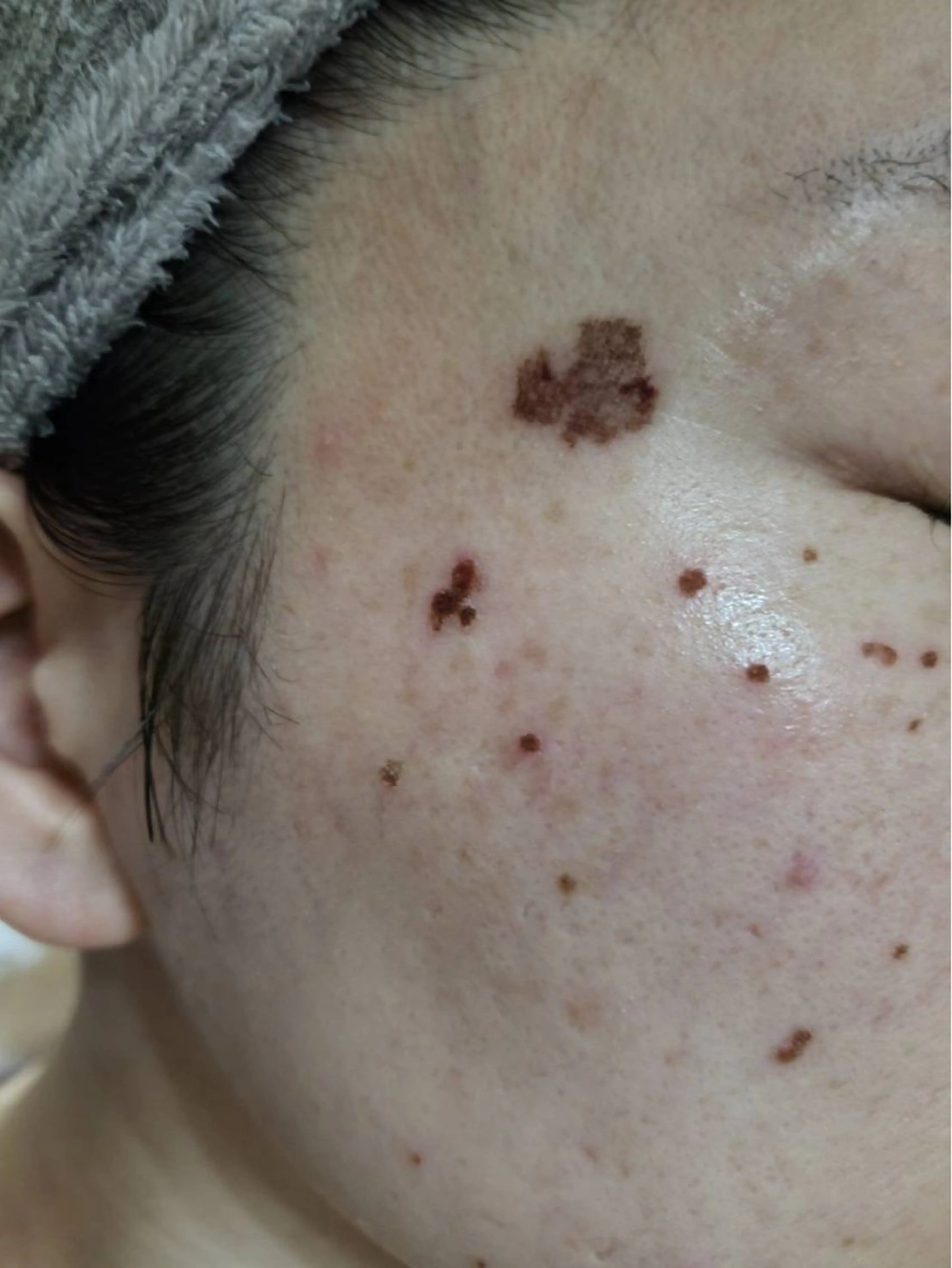 INFINITY 神戸店のエステ・リラクイメージ