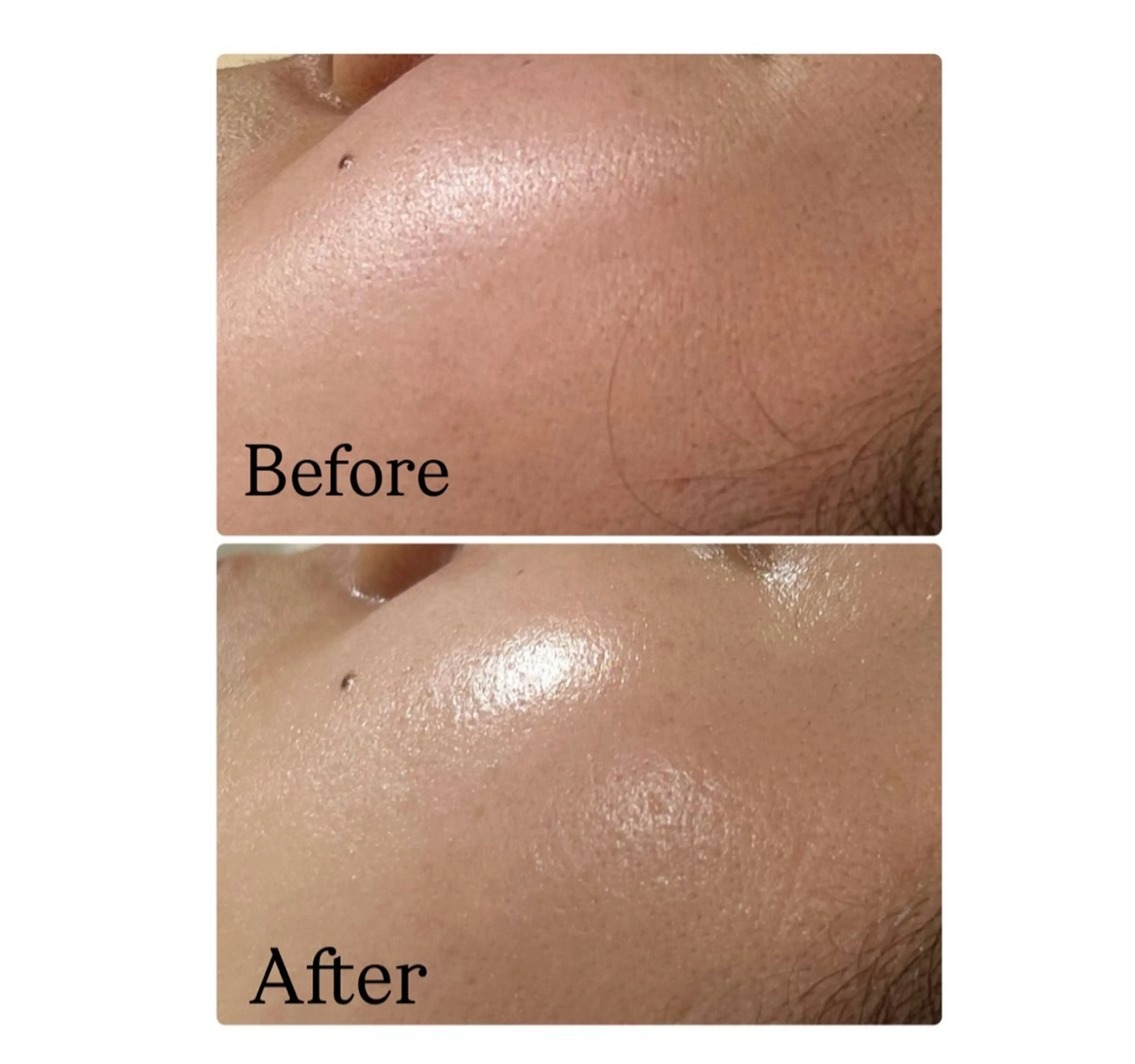 エステ ROR Akariのエステ・リラクイメージ