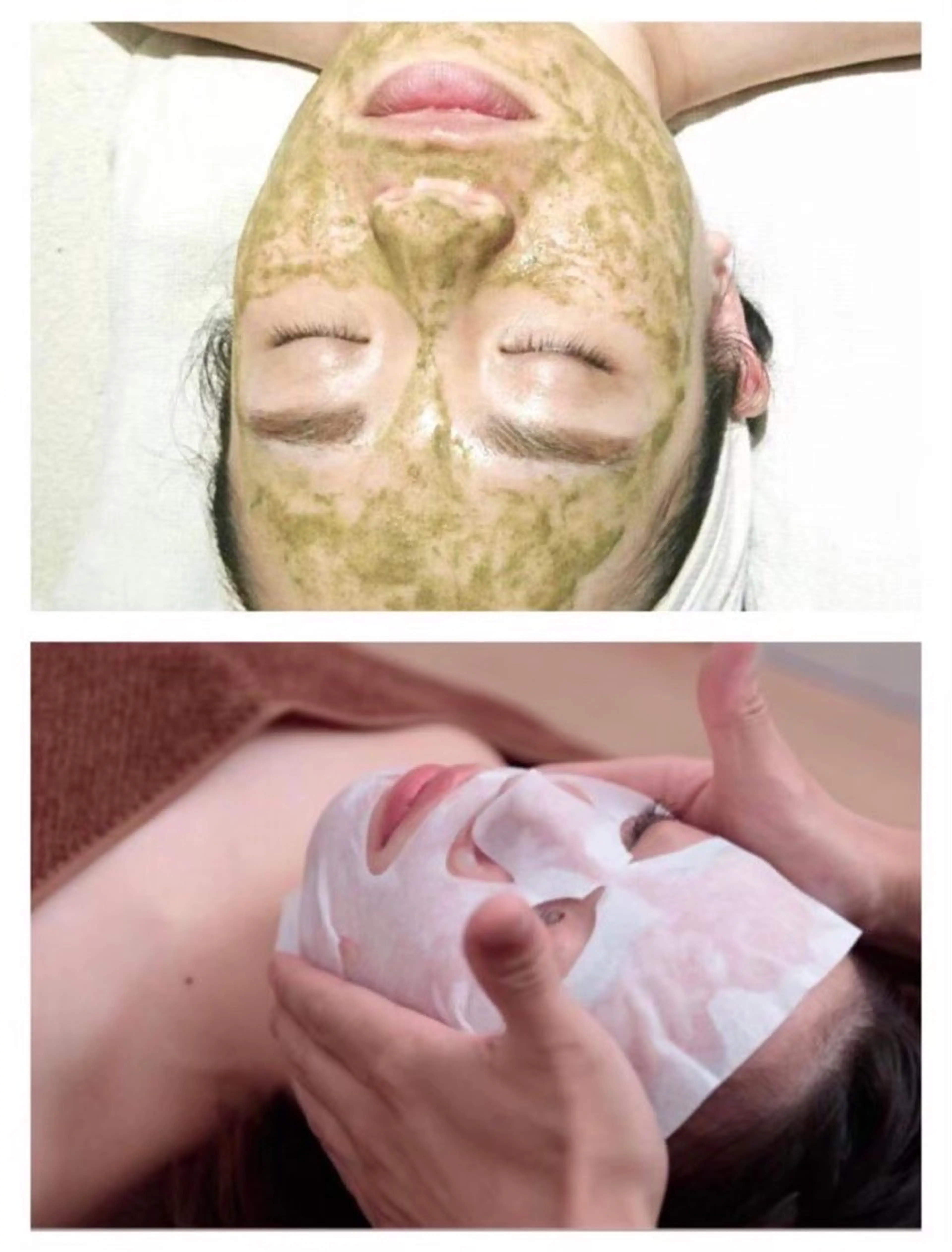 【ハーブピーリング+カーボキシー炭酸ガスパック】大人気セット✨(ニキビ/毛穴/くすみ/たるみ/ザラつき/乾燥等)の写真