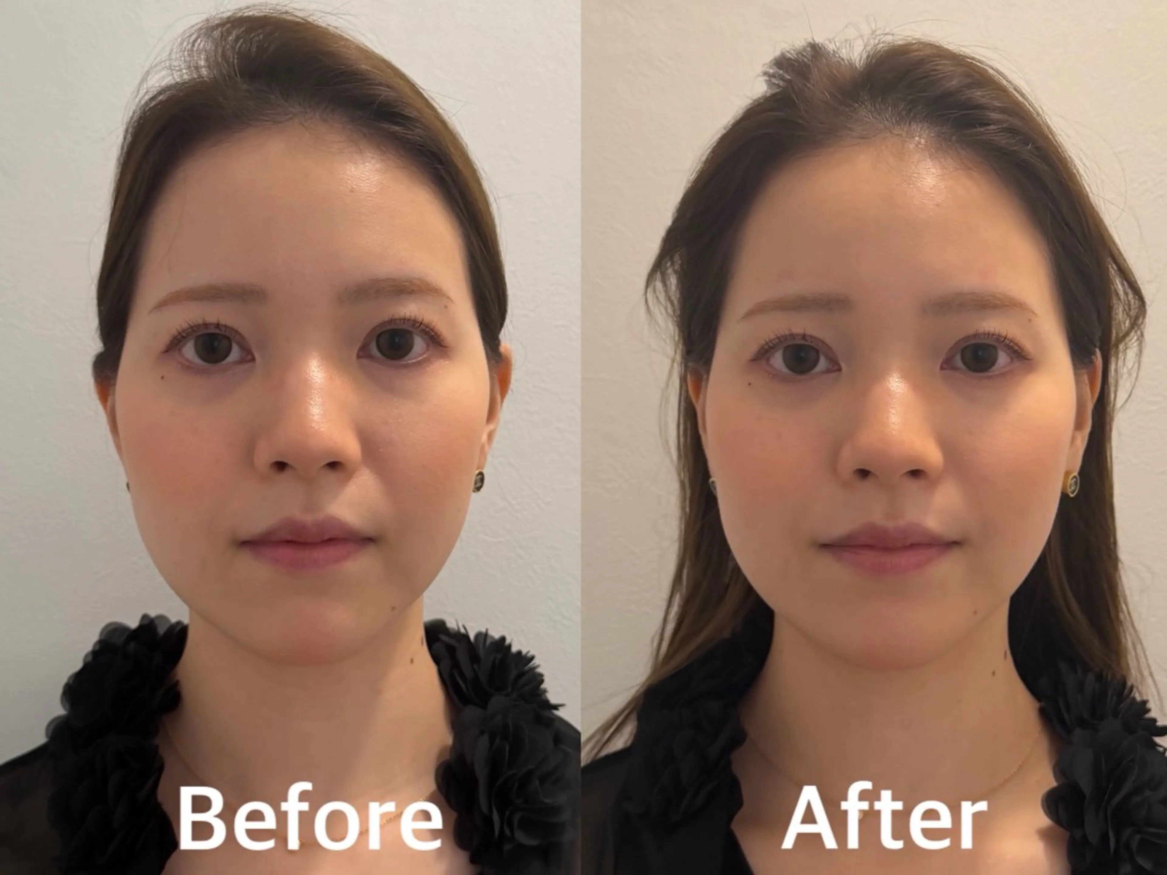 その他 佐藤 咲希のエステ・リラクイメージ