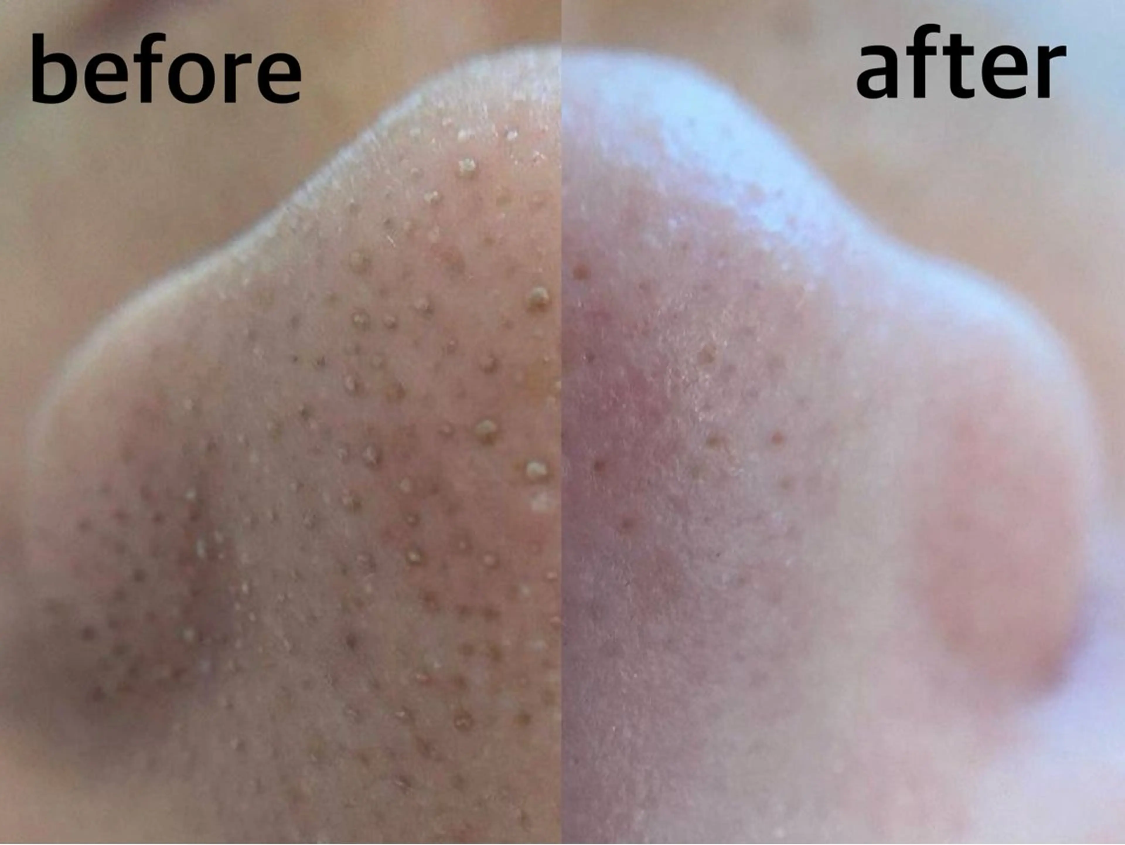 韓国式３D毛穴洗浄＆ 脱毛vive京橋のエステ・リラクイメージ