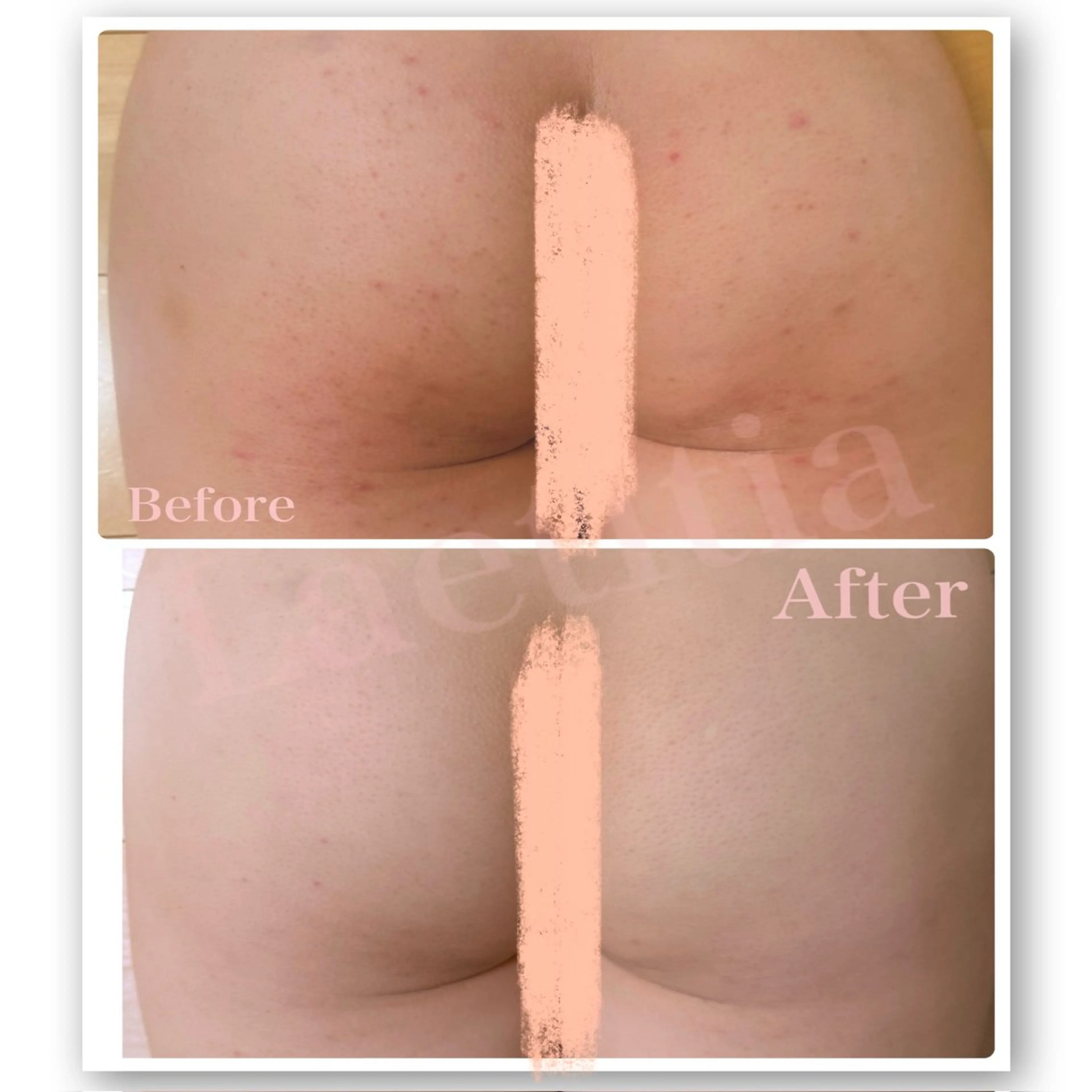 エステ レティティア【Laetitia】所属・レティティア秋葉原店 Yoshizawaのエステ・リラクイメージ