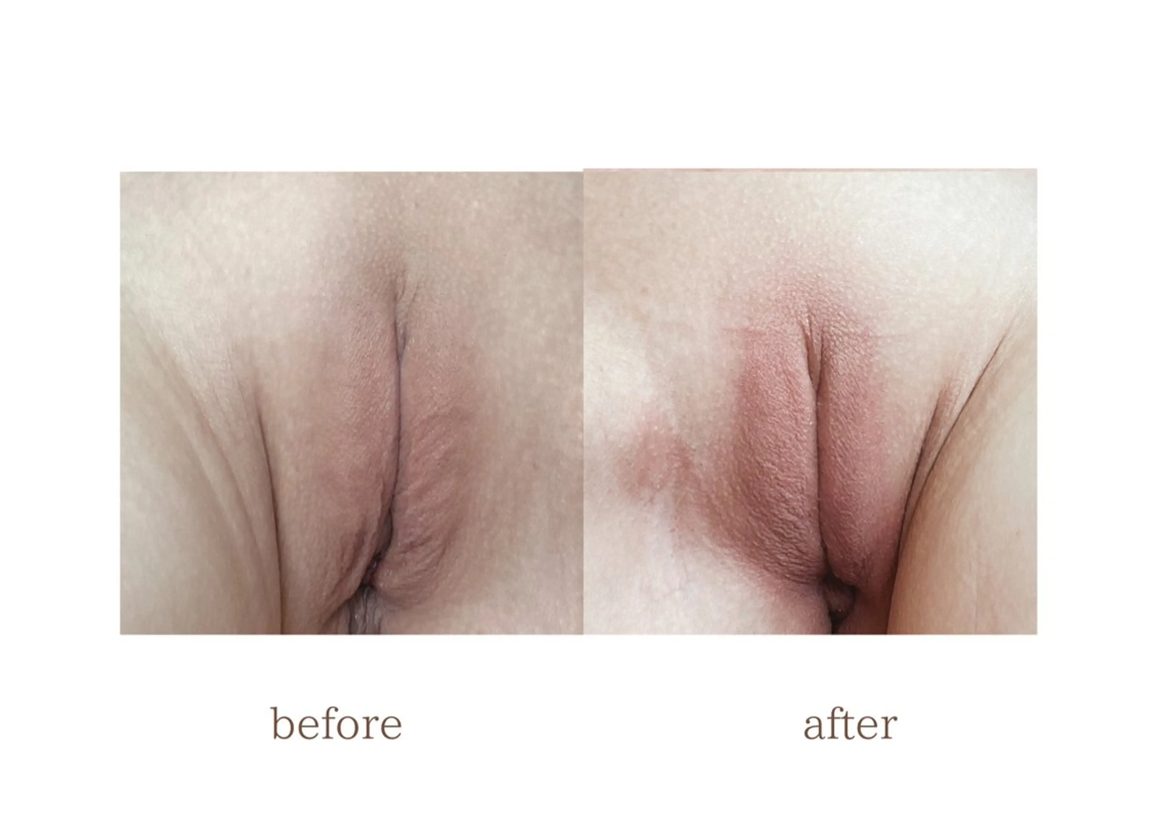 A.所属・Raviy(A.) 【痩身・韓国肌管理】のエステ・リラクイメージ