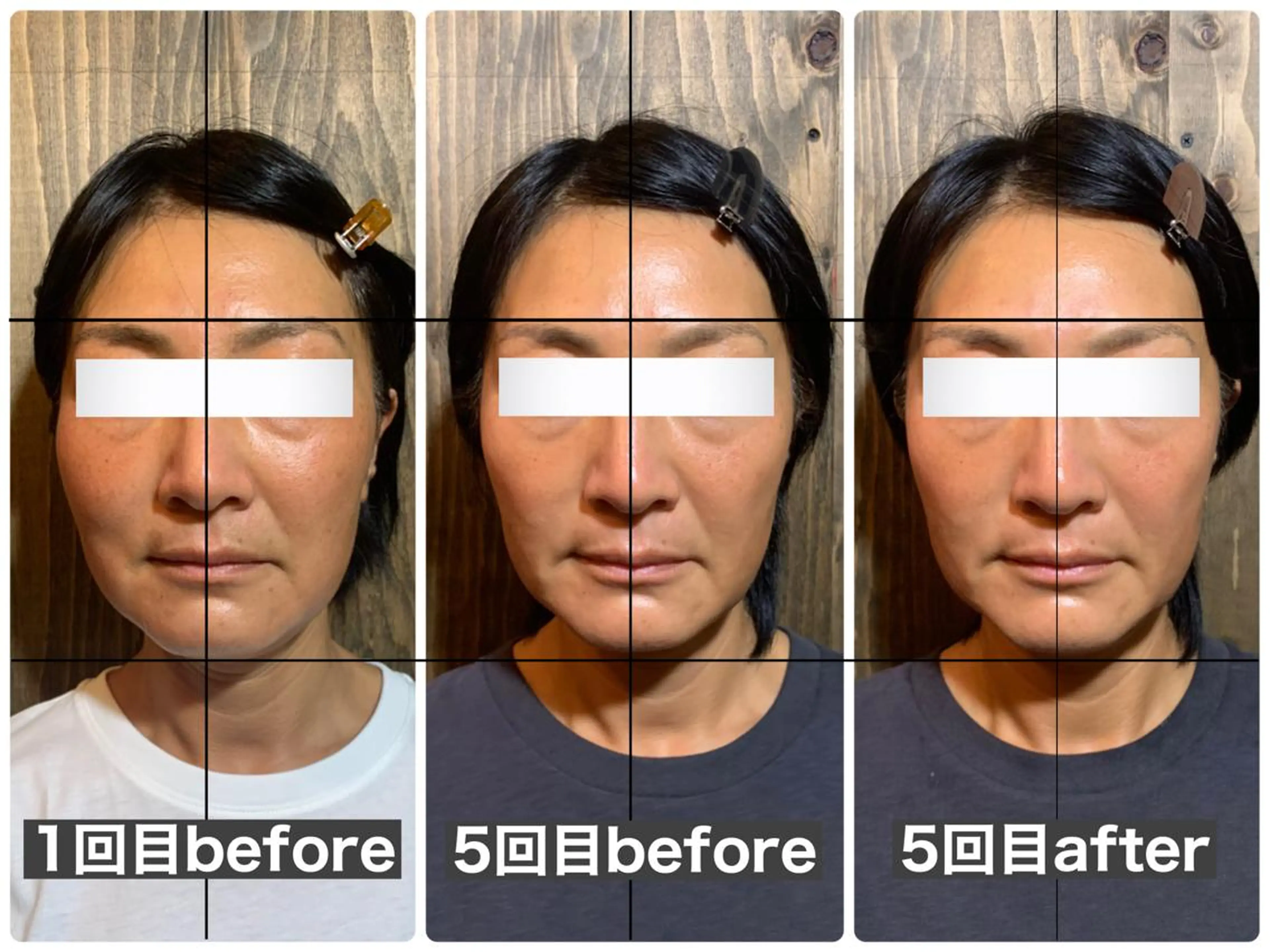 エステ リラク 💎後悔させない小顔 矯正💎イトヤマ🌱のエステ・リラクイメージ