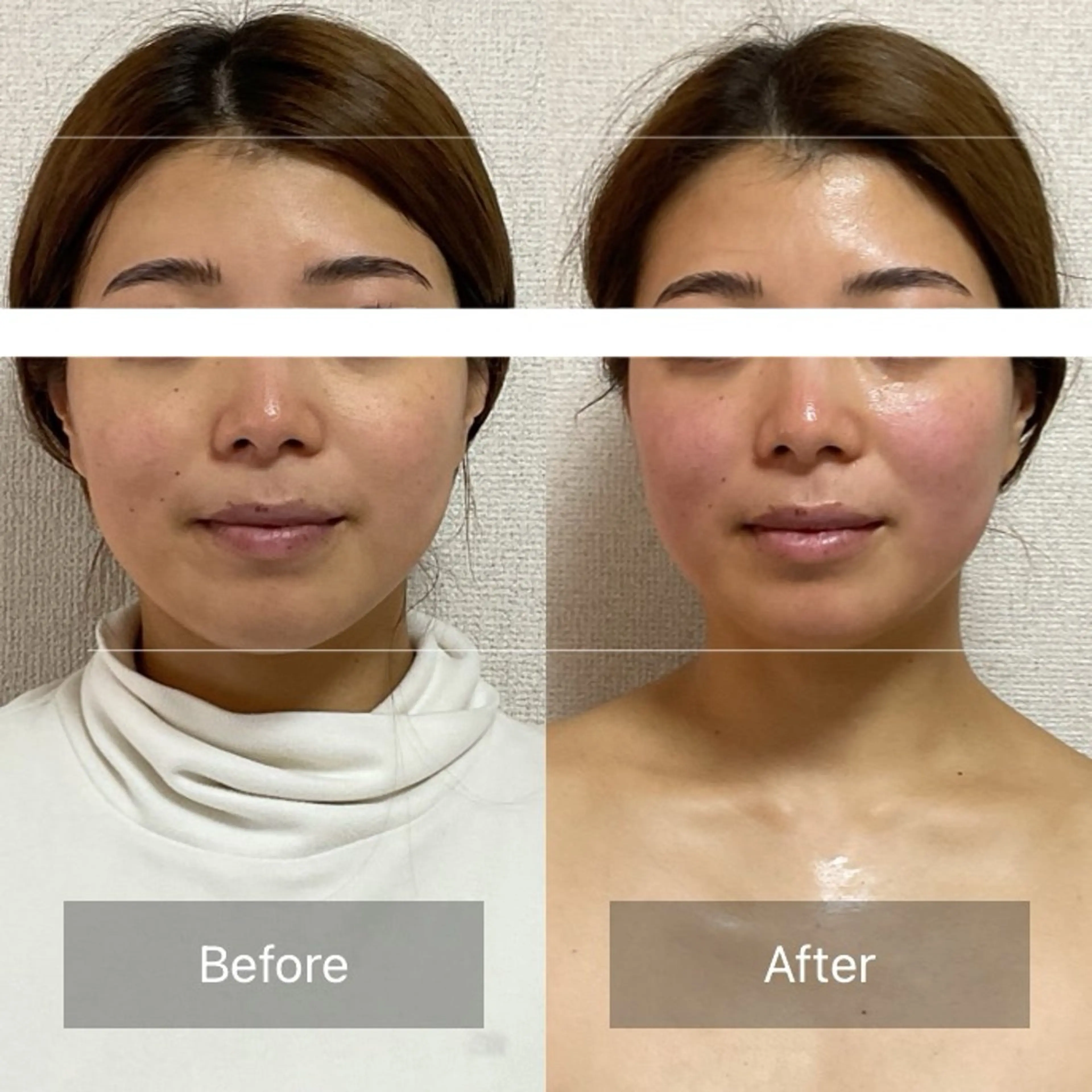 小顔×肌質改善 《お顔の印象》のエステ・リラクイメージ