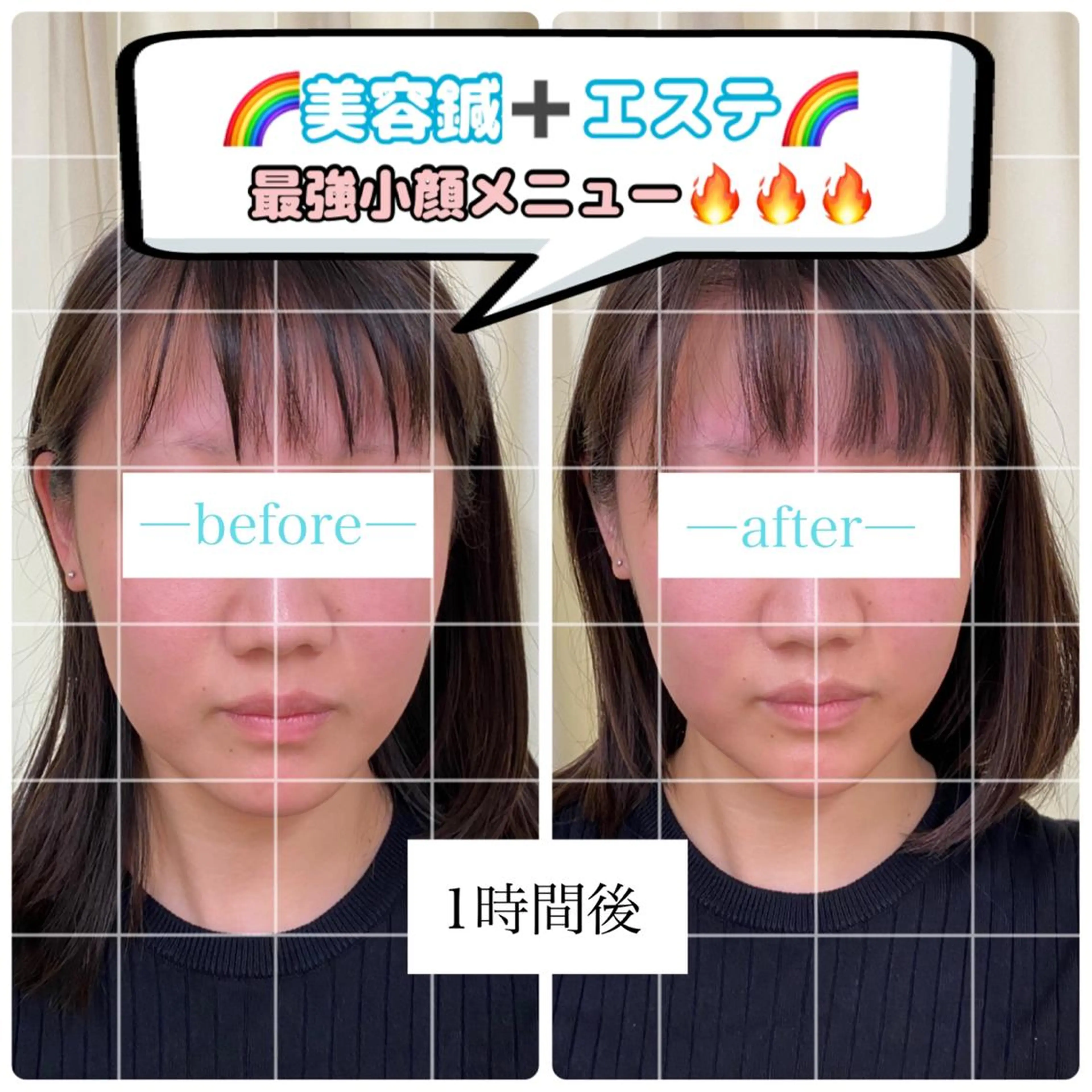 その他 鍼灸サロン BBB3のその他イメージ