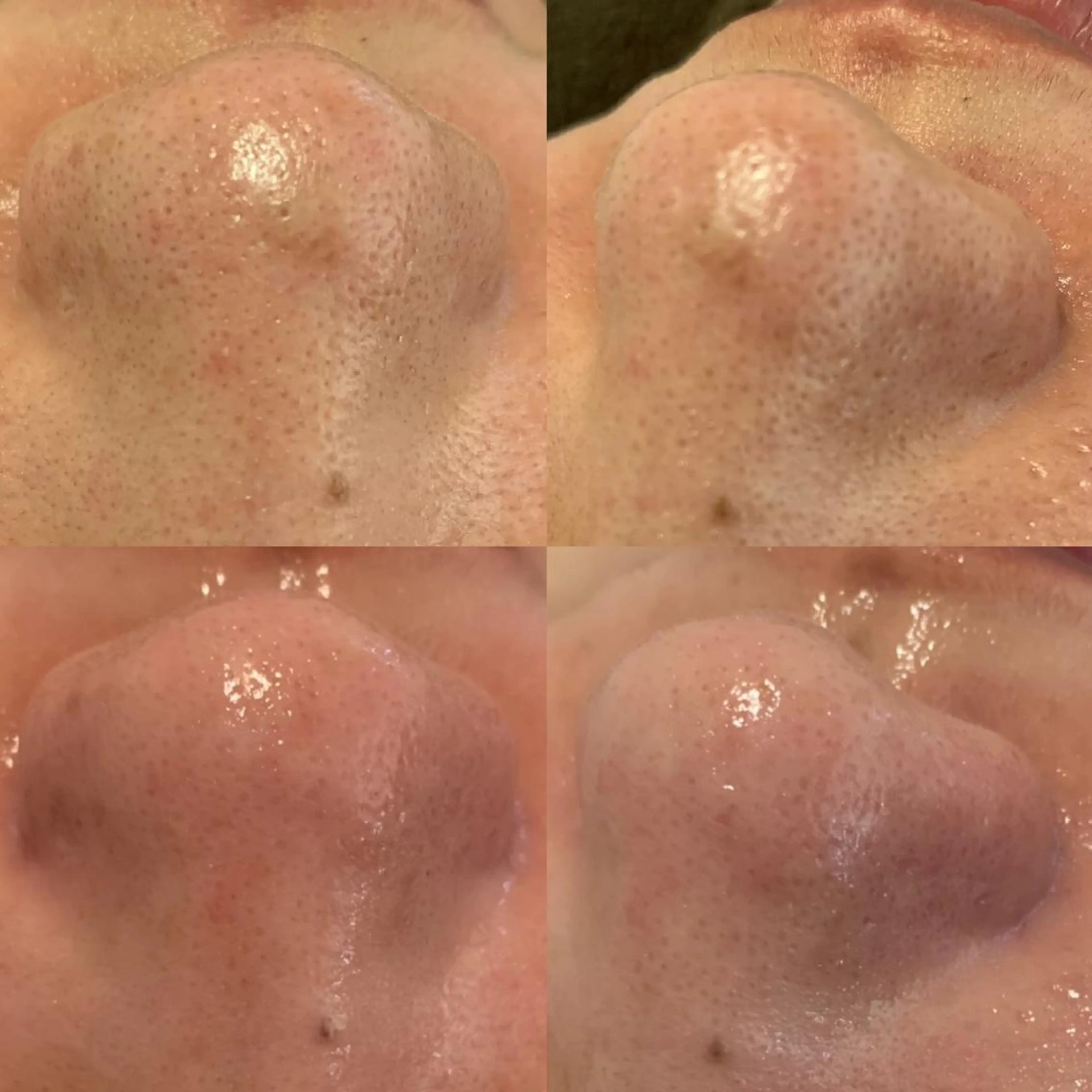 エステ リラク BELCIA福岡店　récolte de BELCIA（レコルトデベルシア）所属・BELCIA福岡店 レコルトデベルシアのエステ・リラクイメージ