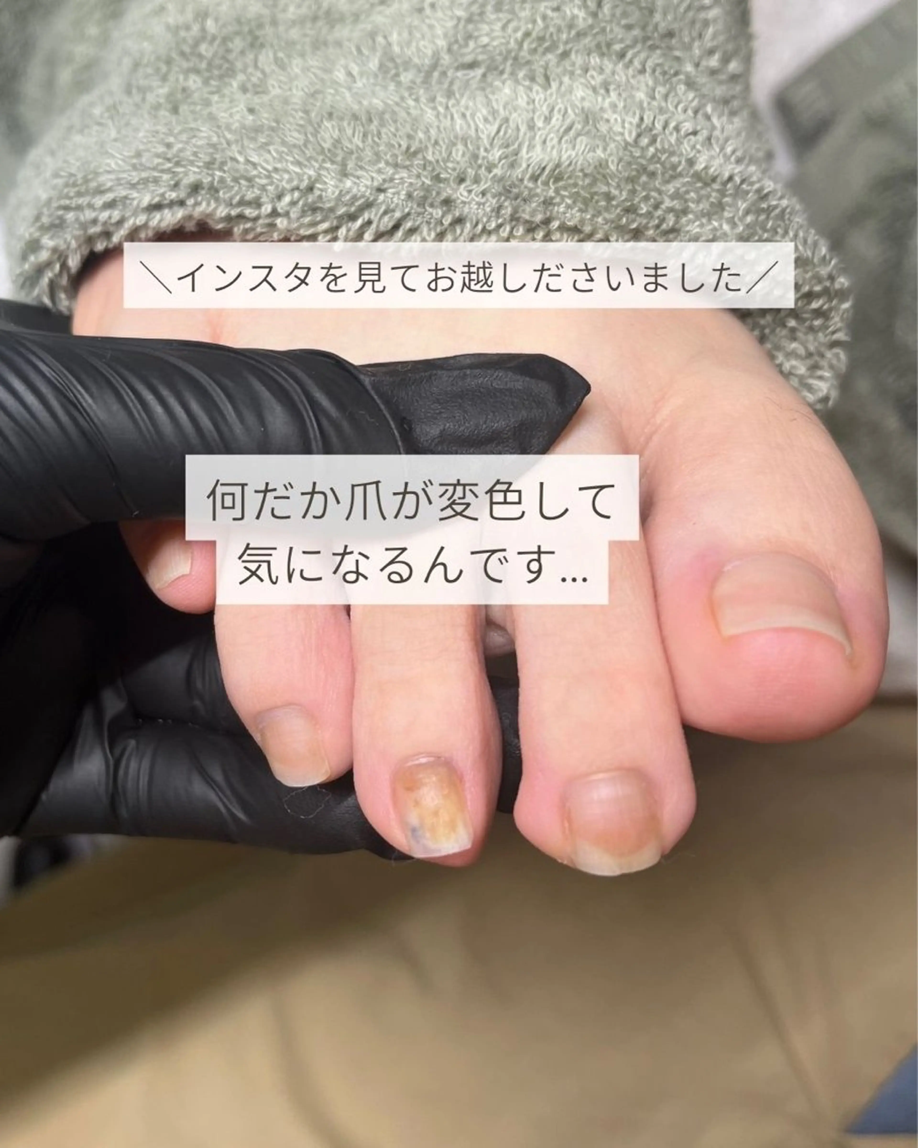 ネイル フットネイル KIKOA NAIL キコアネイルのネイルデザイン