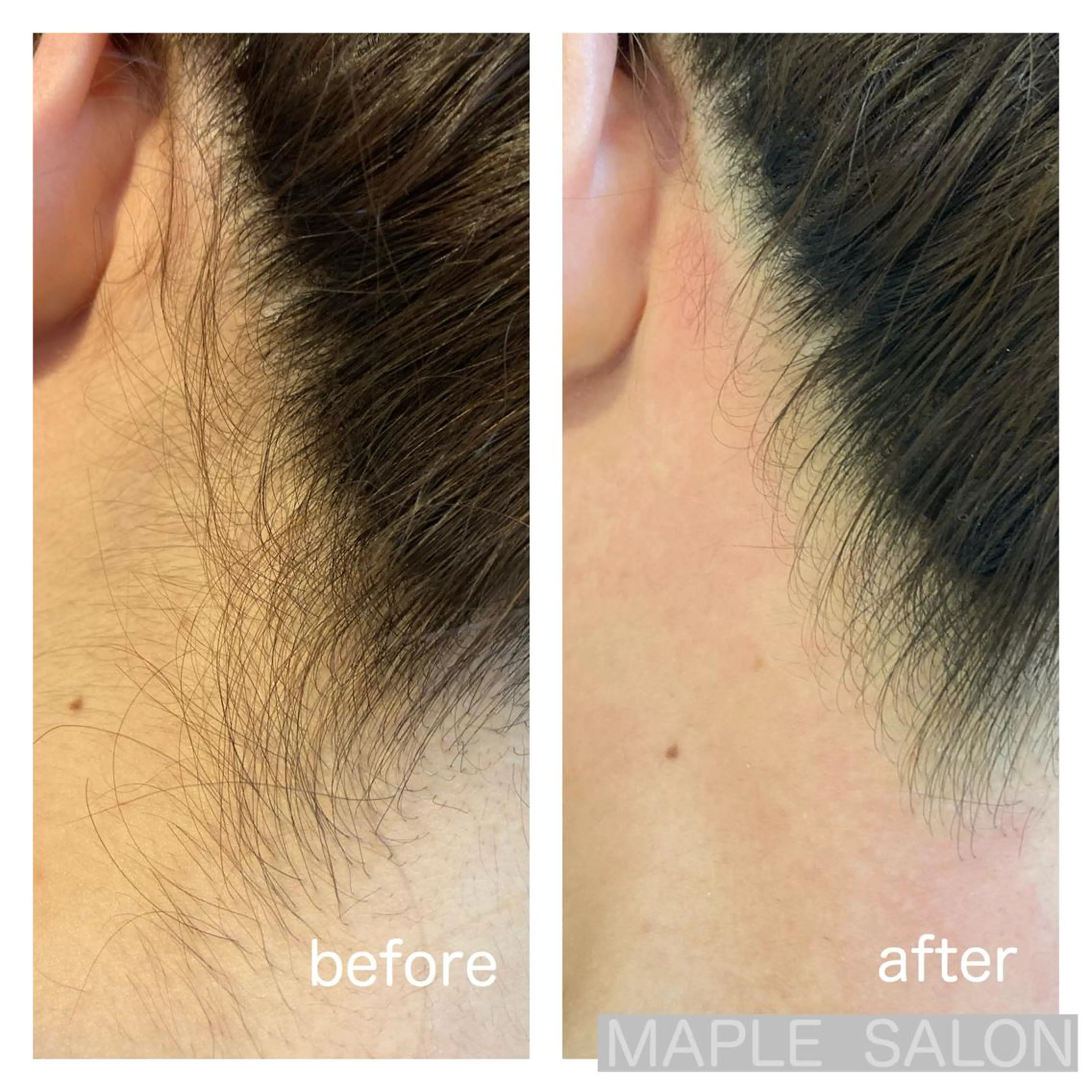 脱毛 MARI シュガーリストのエステ・リラクイメージ