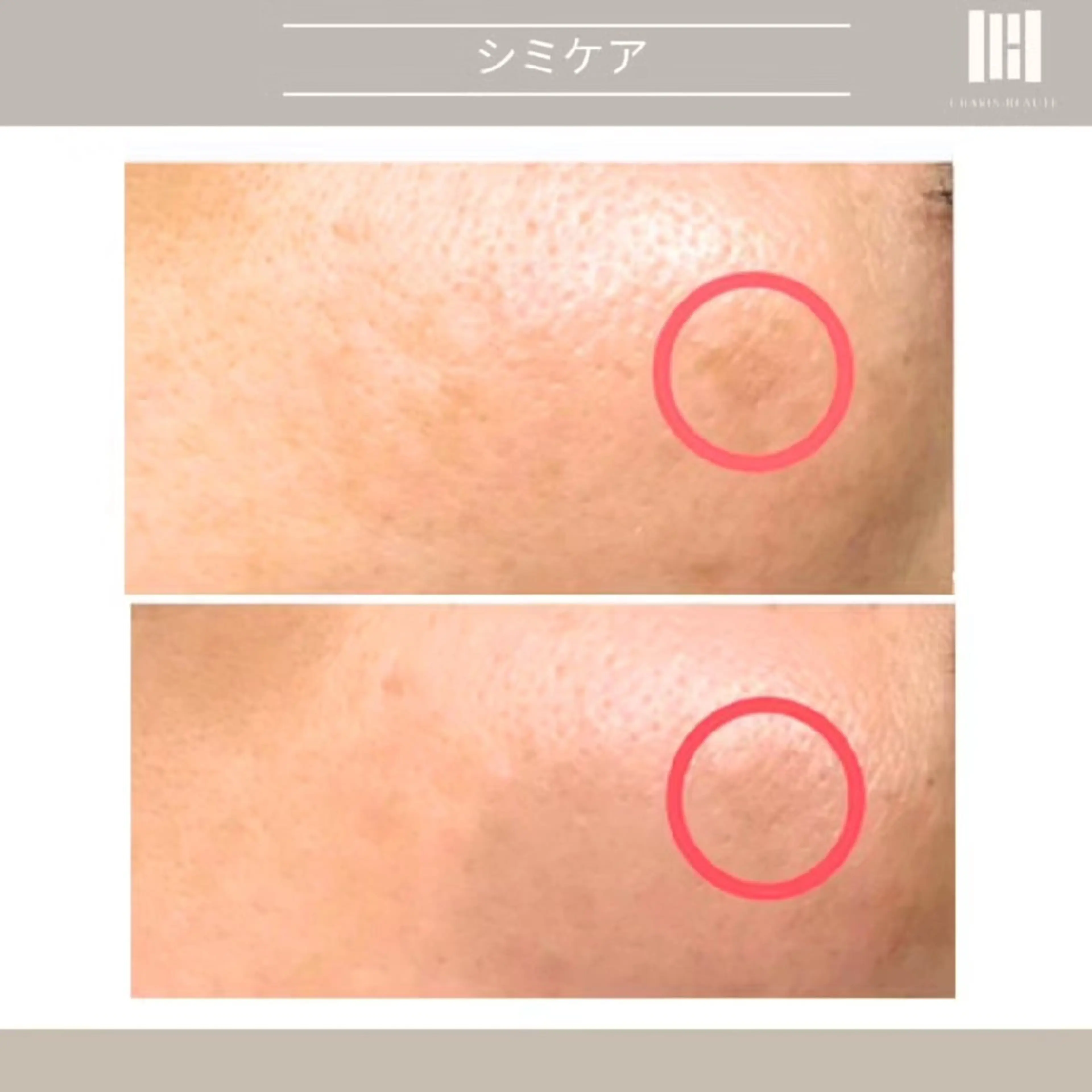 エステ 上杉 彩のエステ・リラクイメージ