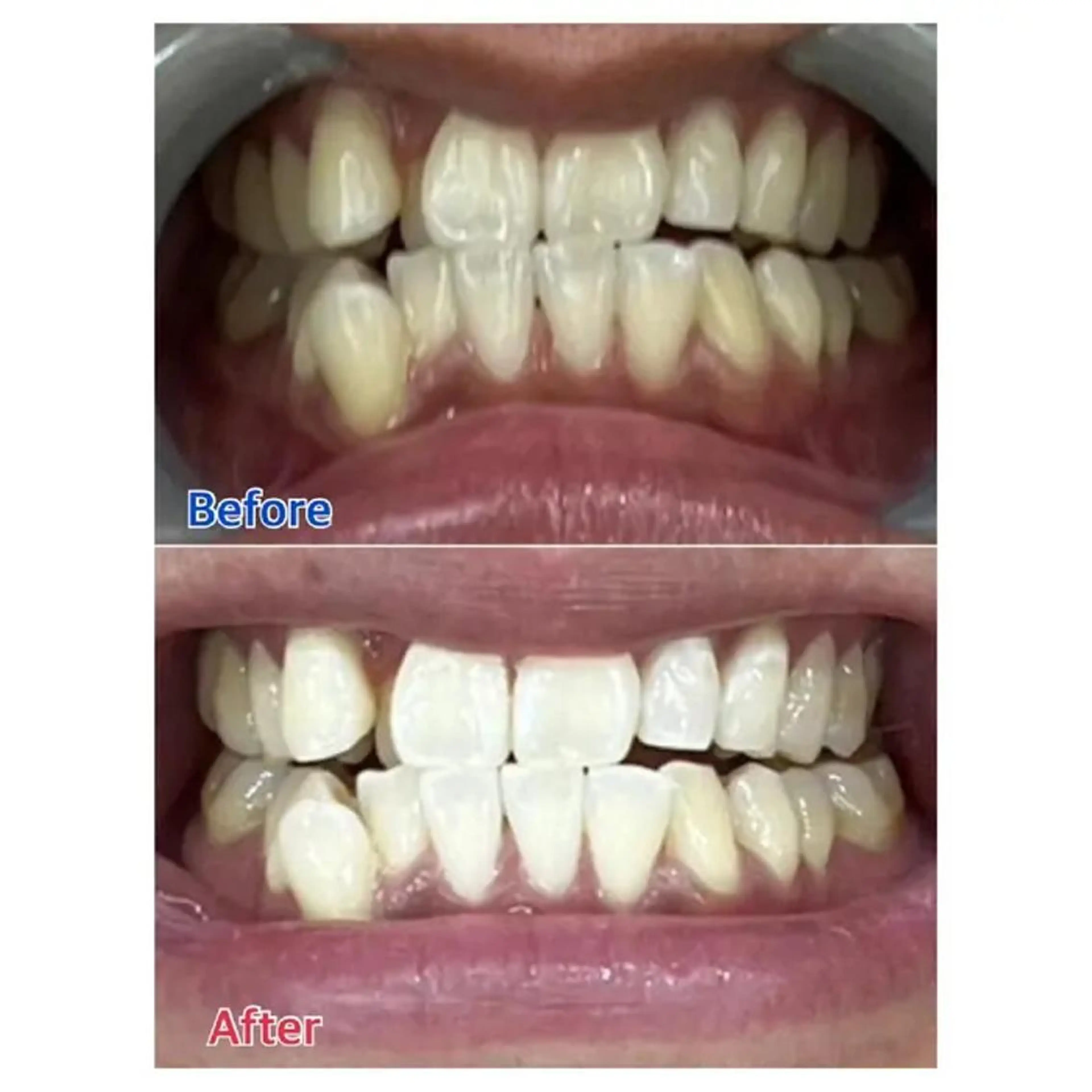 M渋谷 ホワイトニングのエステ・リラクイメージ