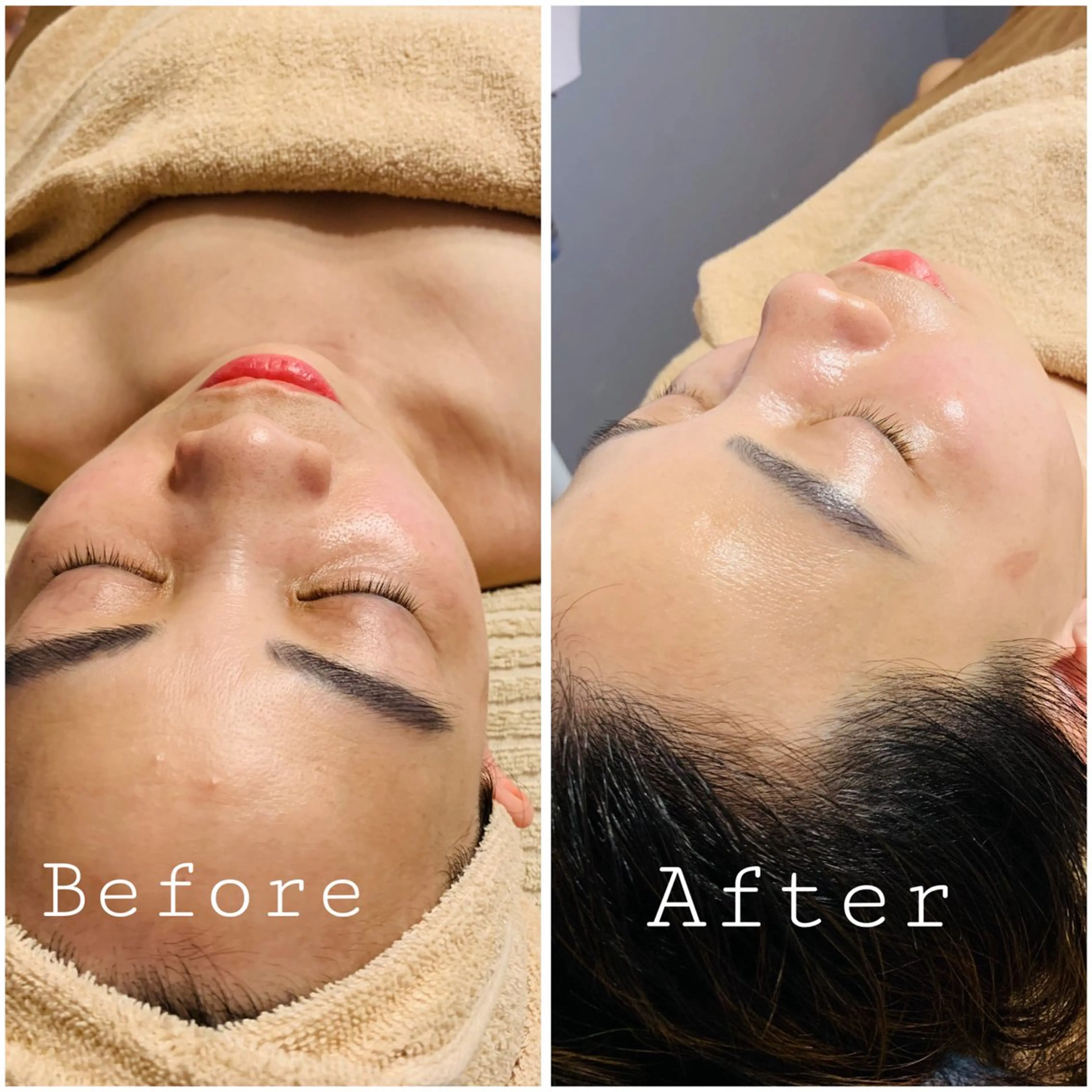 美肌的にビタミンC導入の写真