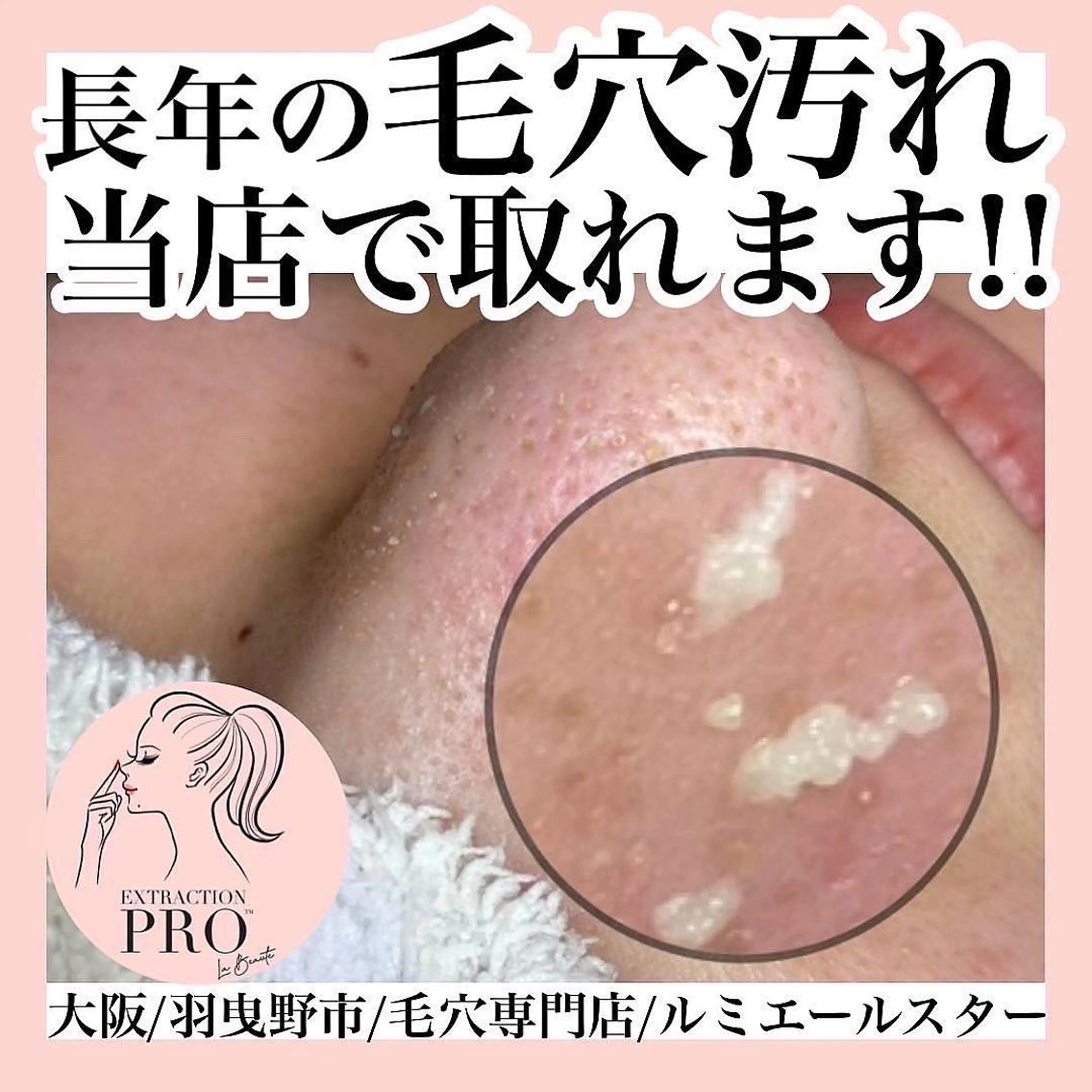 エステ 最速 毛穴シミ改善 いくえのその他イメージ