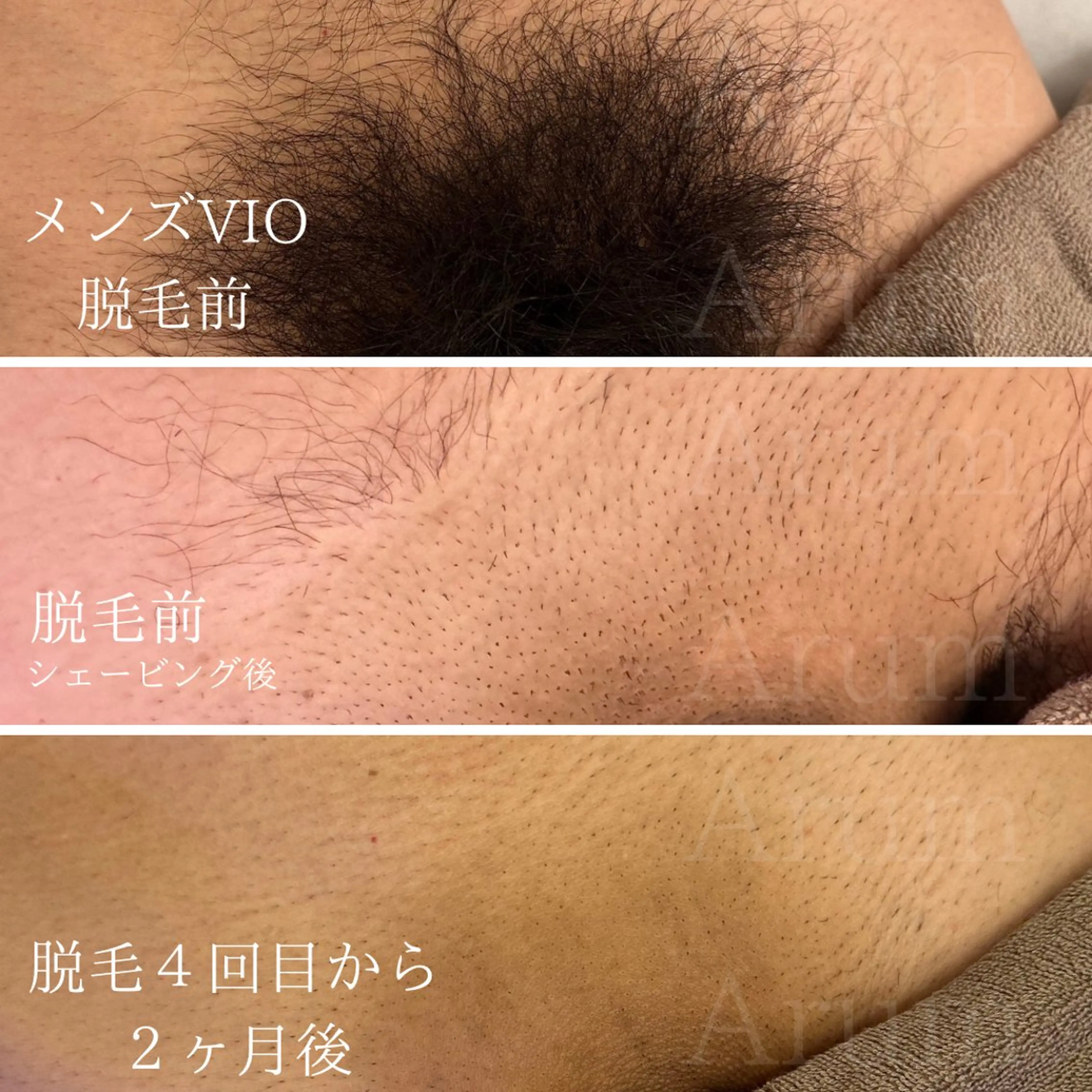 メンズ 脱毛サロン Arumのエステ・リラクイメージ